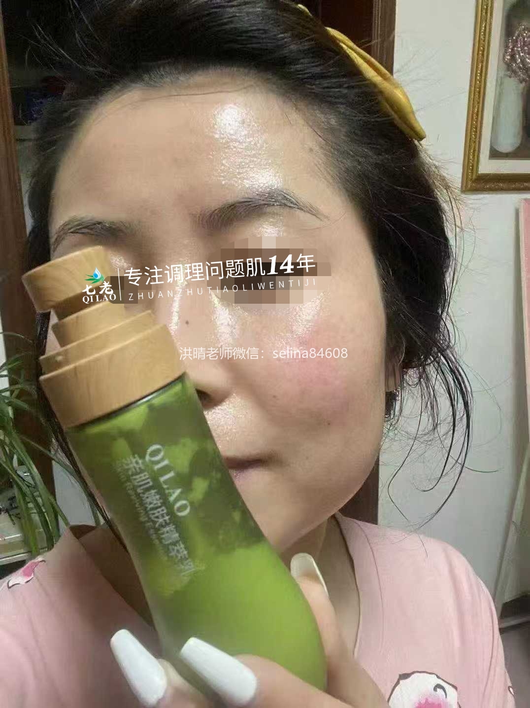 七老激素脸修护案例