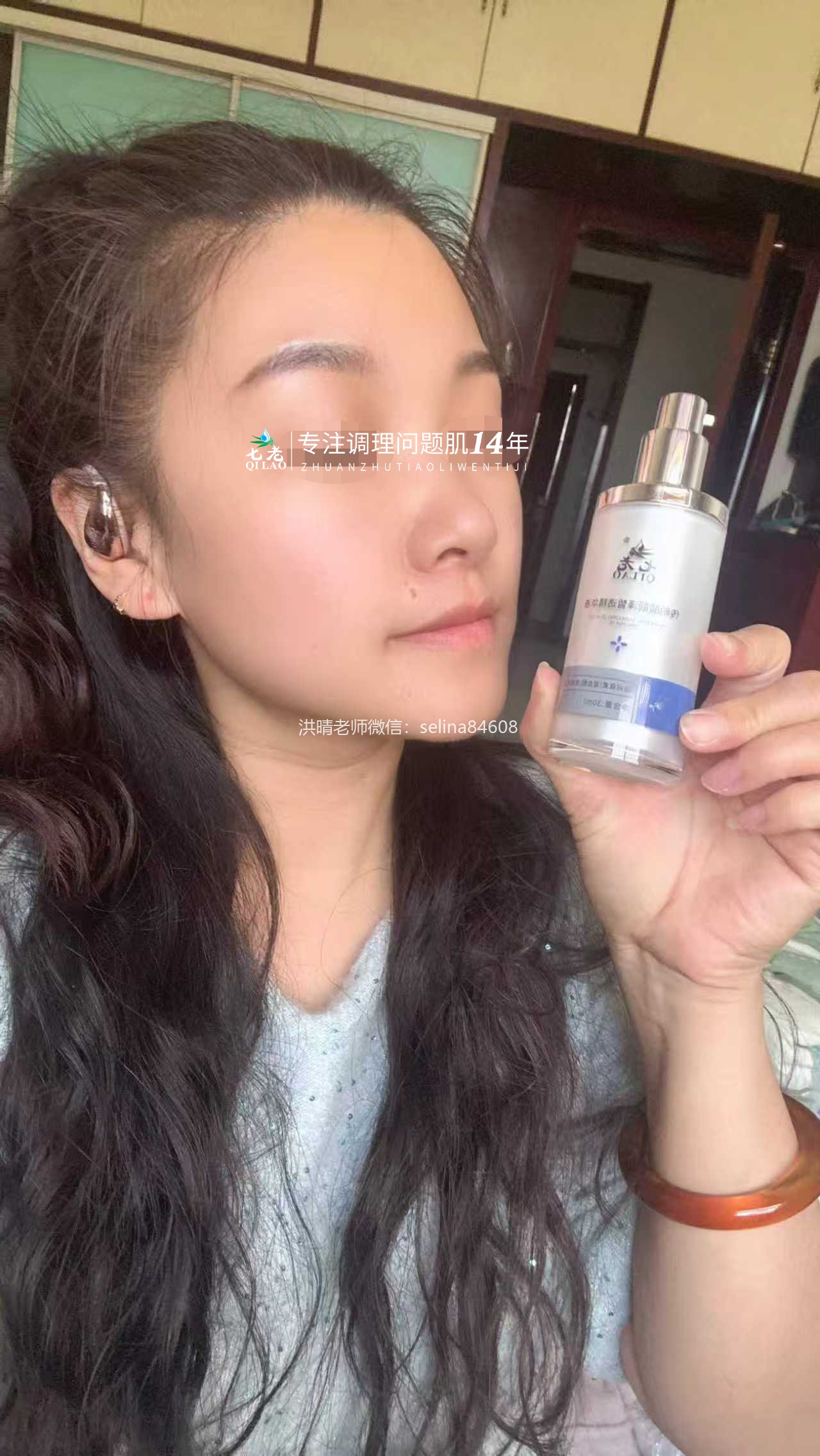 七老激素脸红肿烫痒疹子疙瘩渗液结痂修护案例