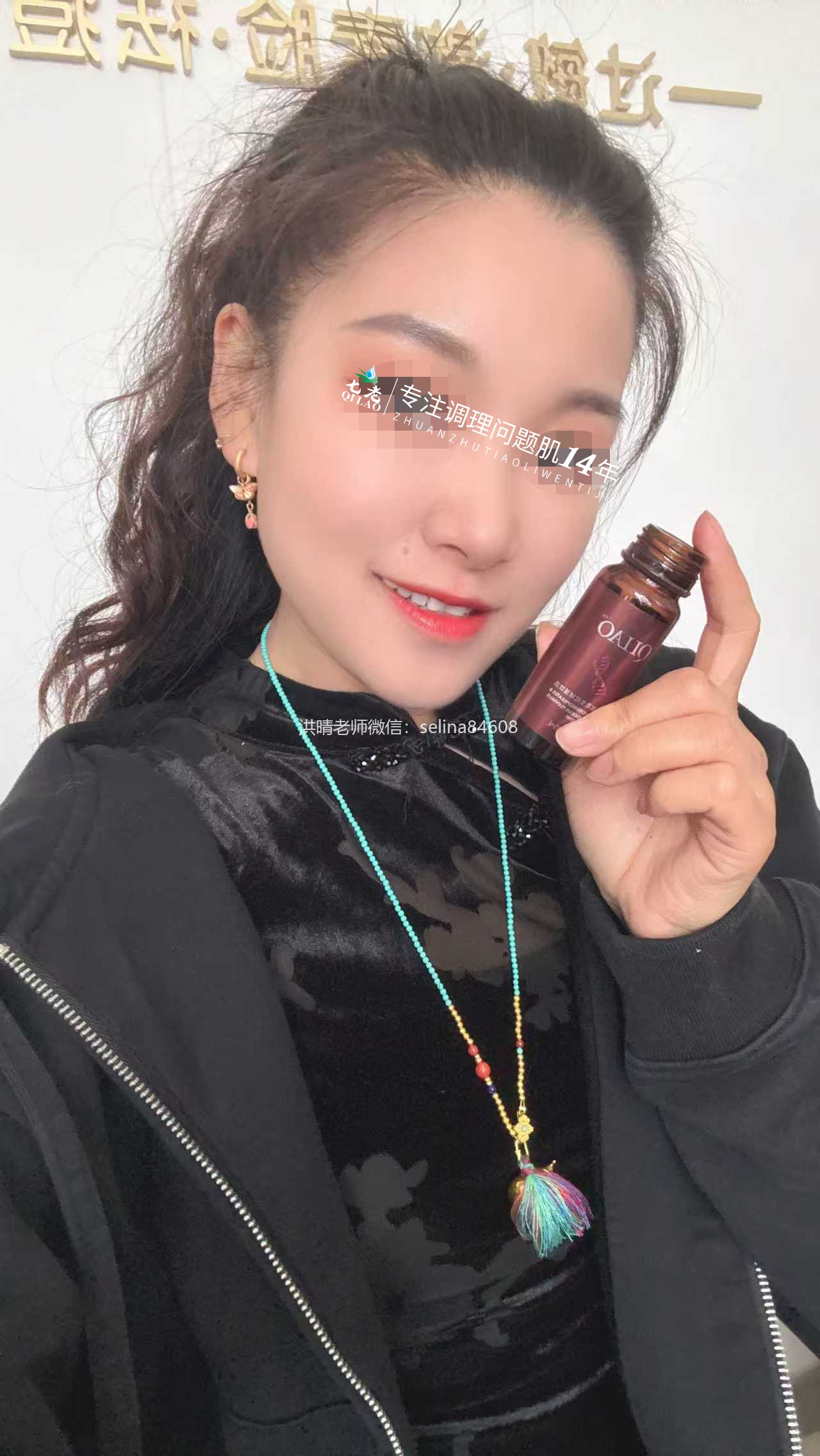 七老激素脸红肿烫痒疹子疙瘩渗液结痂修护案例