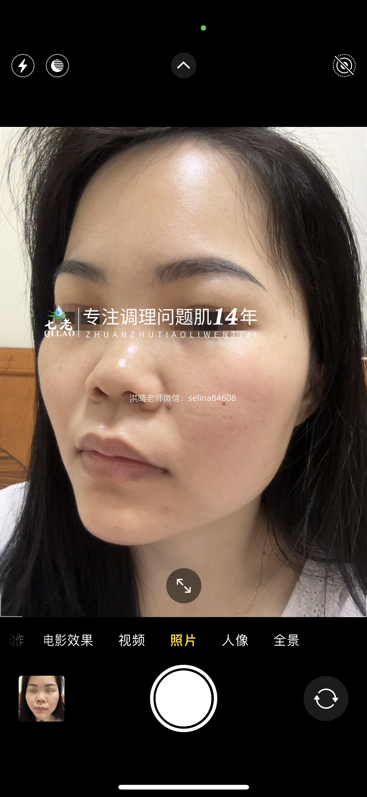 七老发红发烫大红脸红黑脸修护案例