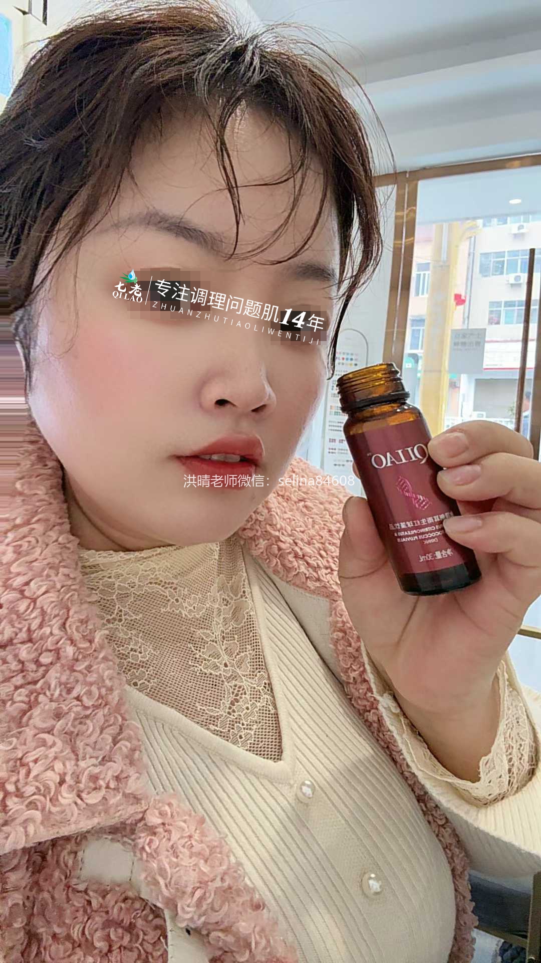 七老激素脸红肿痒反复过敏修护案例