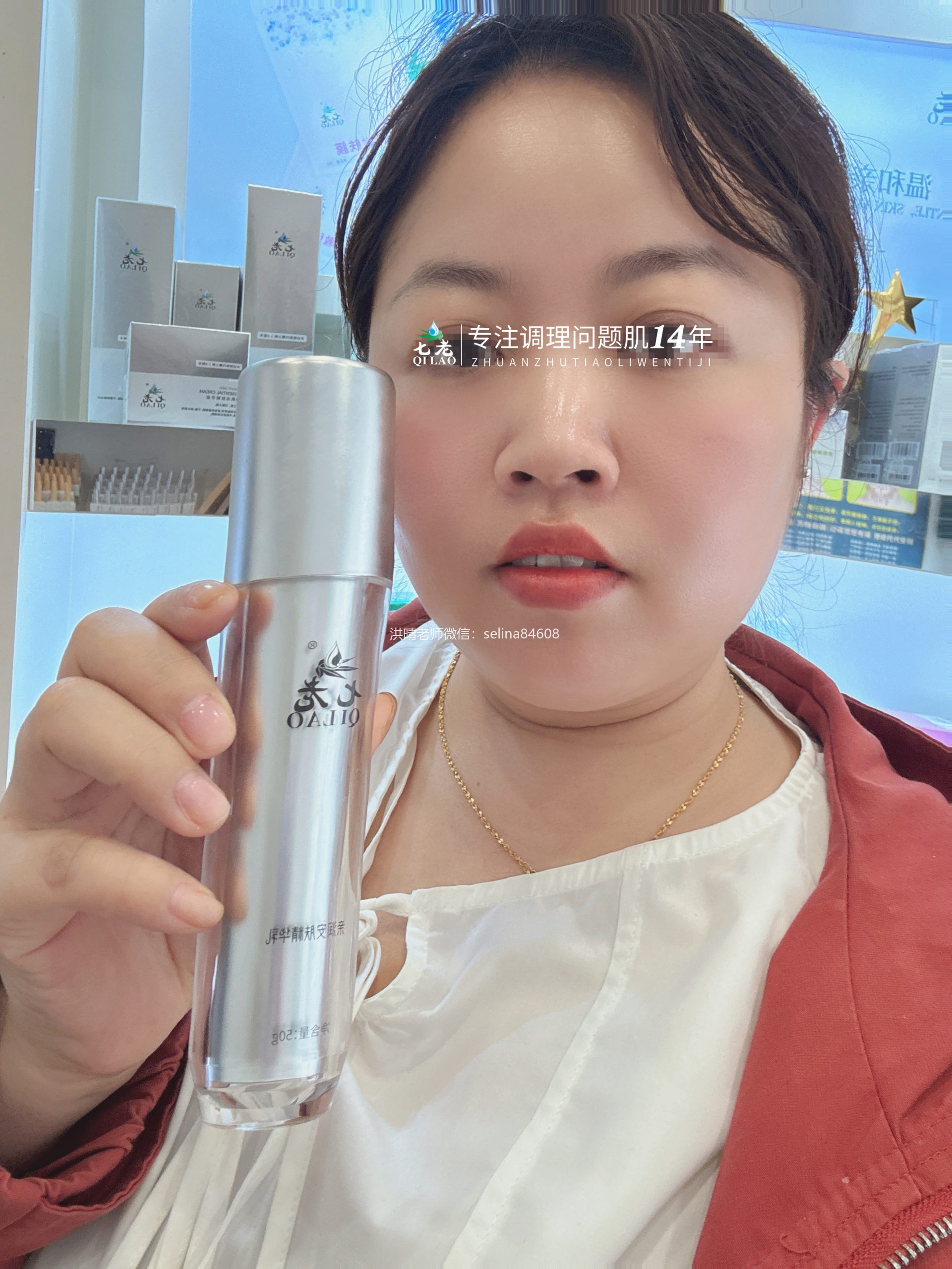 七老激素脸红肿痒反复过敏修护案例