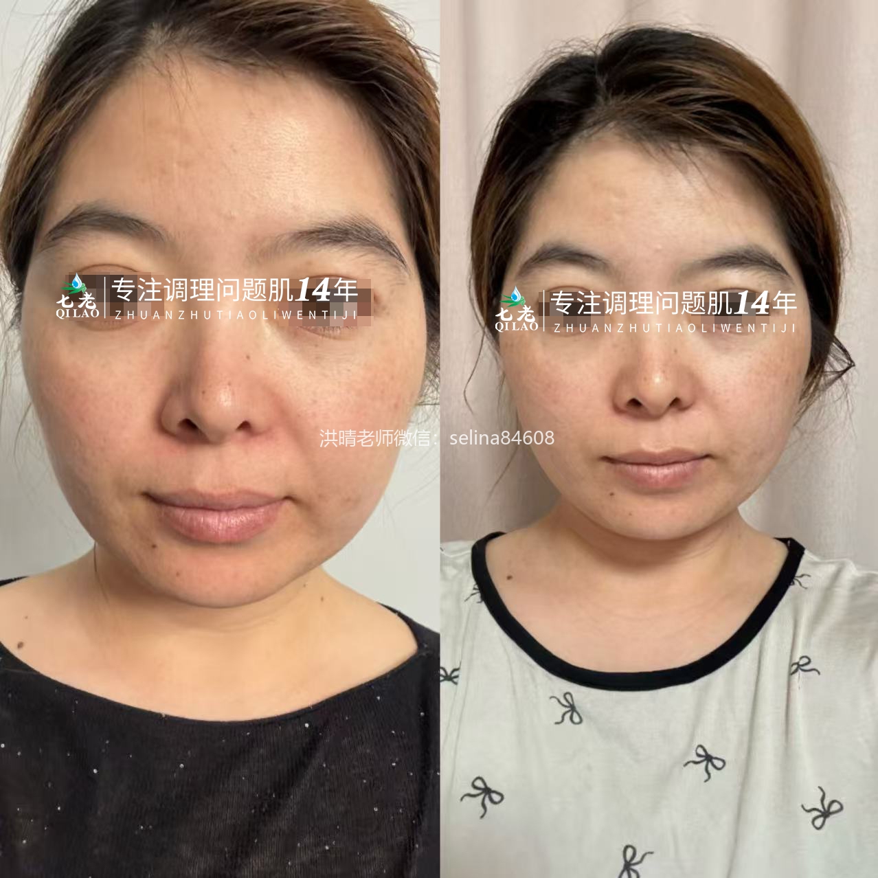 七老四重肽胶原蛋白，紧致抗衰减龄肌