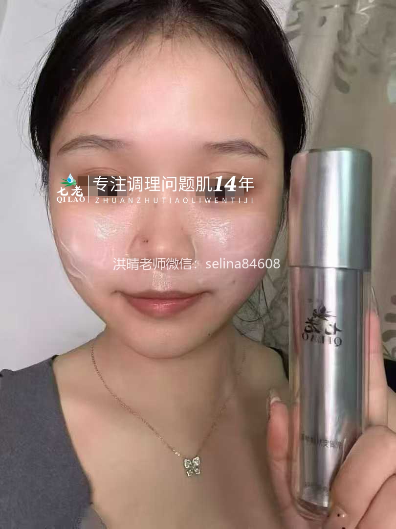 七老脂溢性皮炎修护传明酸反馈