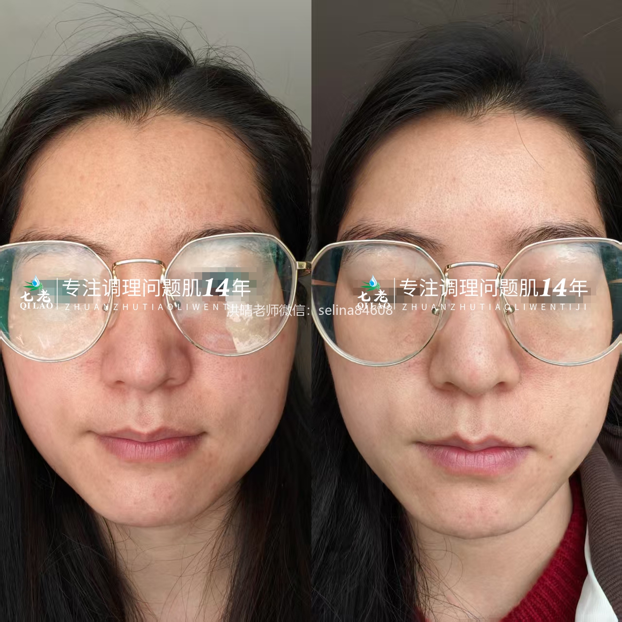 七老四重肽胶原蛋白，紧致抗衰减龄肌