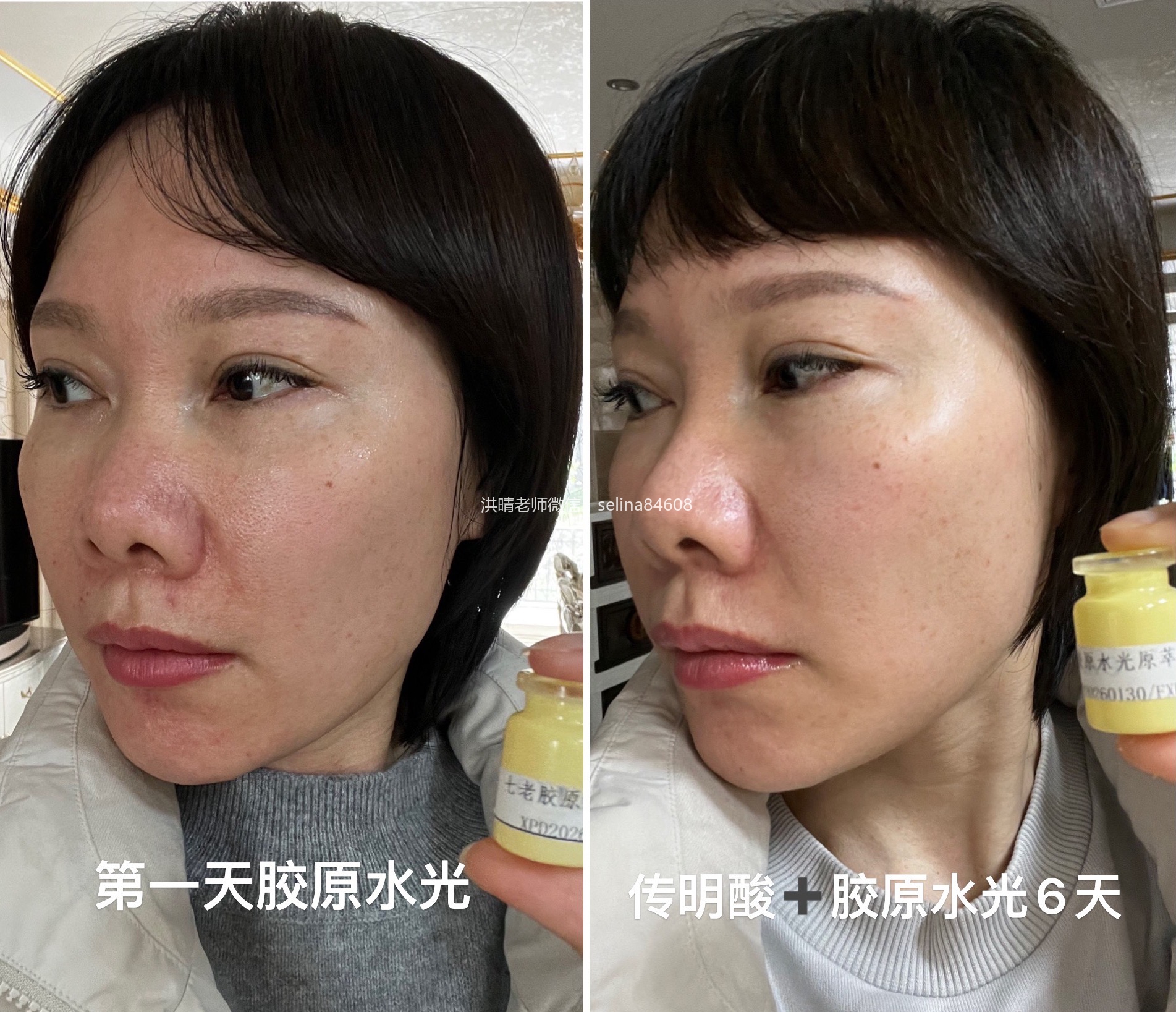 七老胶原修护水光➕传明酸，肌底修护，抗火，亮白