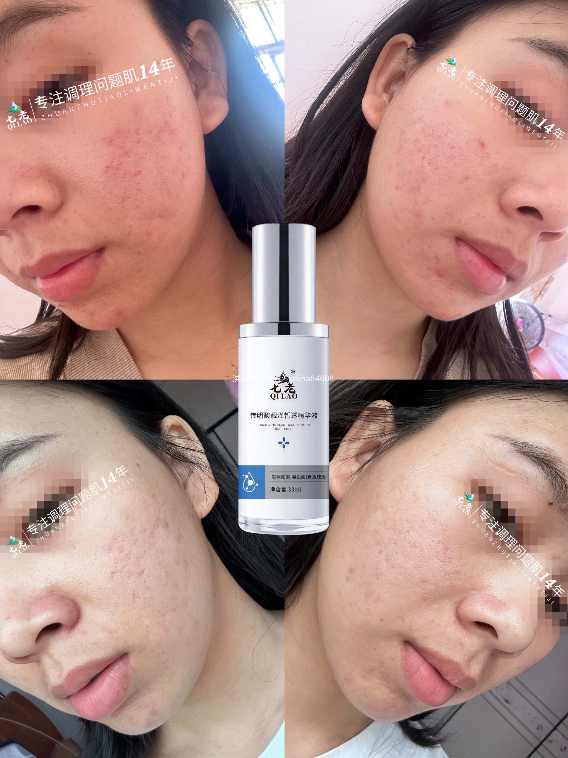 七老传明酸反馈好评