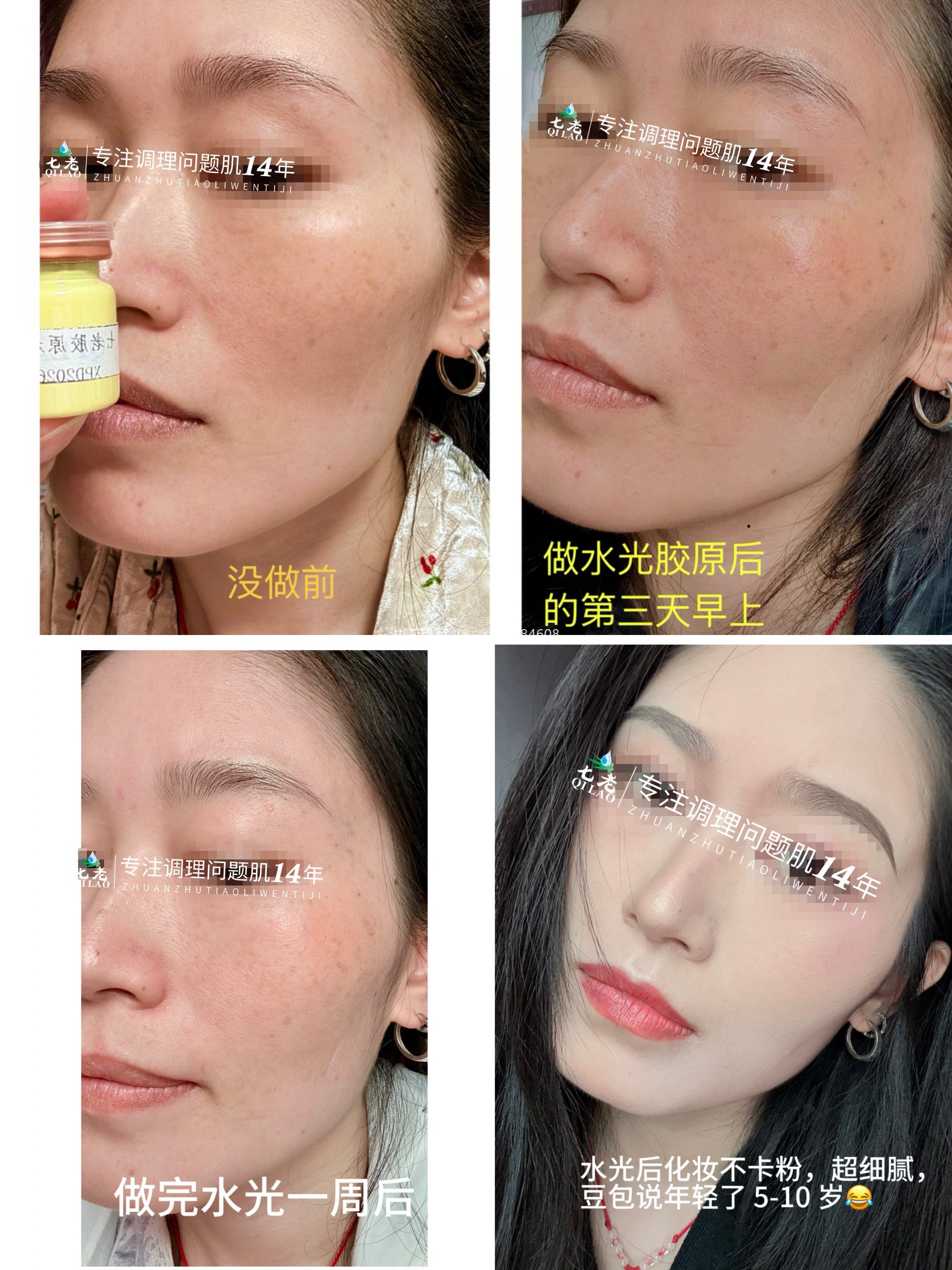 七老新品胶原水光→肌底修护，紧致抗衰于一体，让你皮肤胶原蛋白满满紧致白亮有光泽