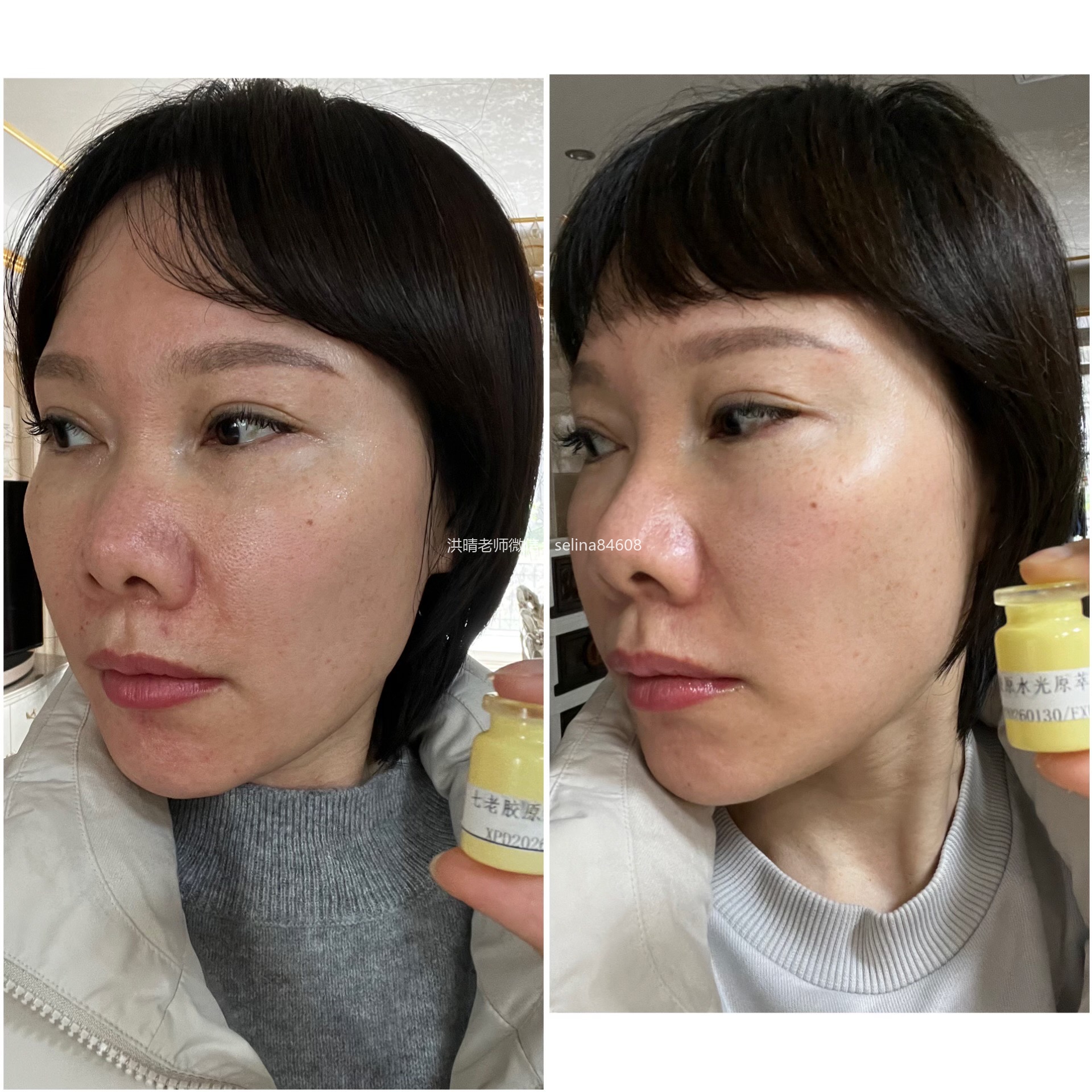 七老胶原修护水光➕传明酸，肌底修护，抗火，亮白