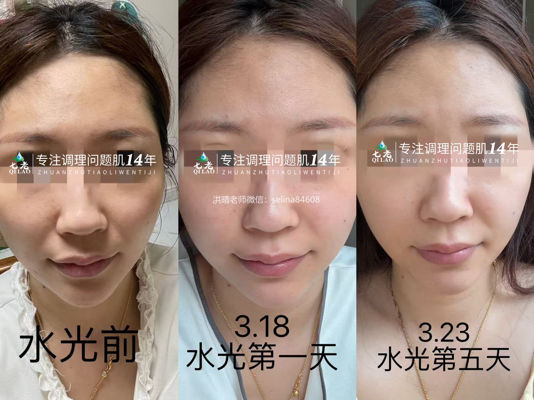 七老新品胶原水光→肌底修护，紧致抗衰于一体，让你皮肤胶原蛋白满满紧致白亮有光泽