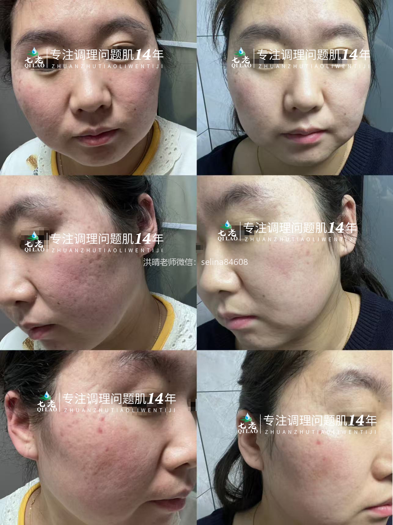 七老四重肽胶原蛋白