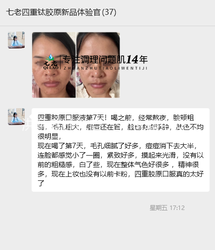 七老四重肽胶原蛋白，胶原直补，水润紧致饱满抗衰老绝绝子