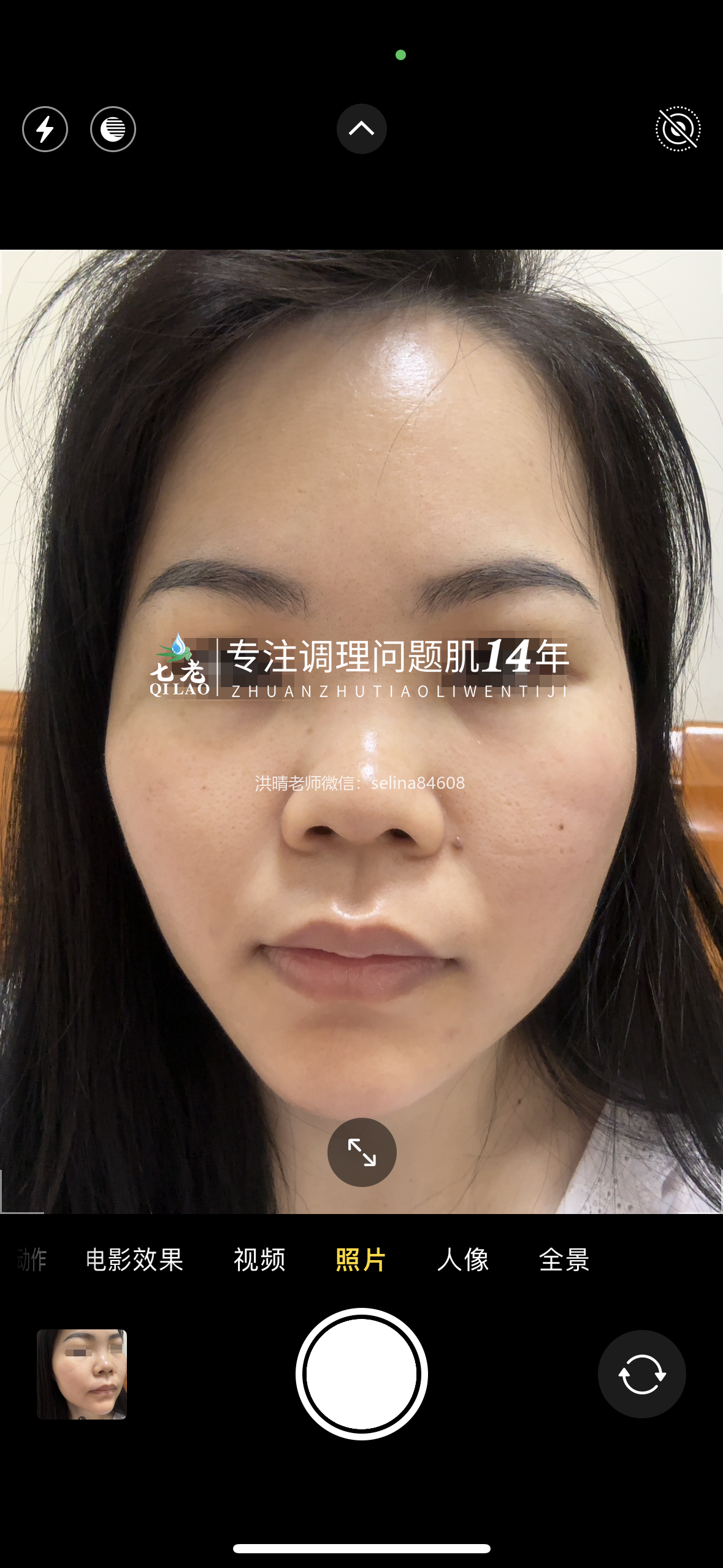 七老发红发烫大红脸红黑脸修护案例