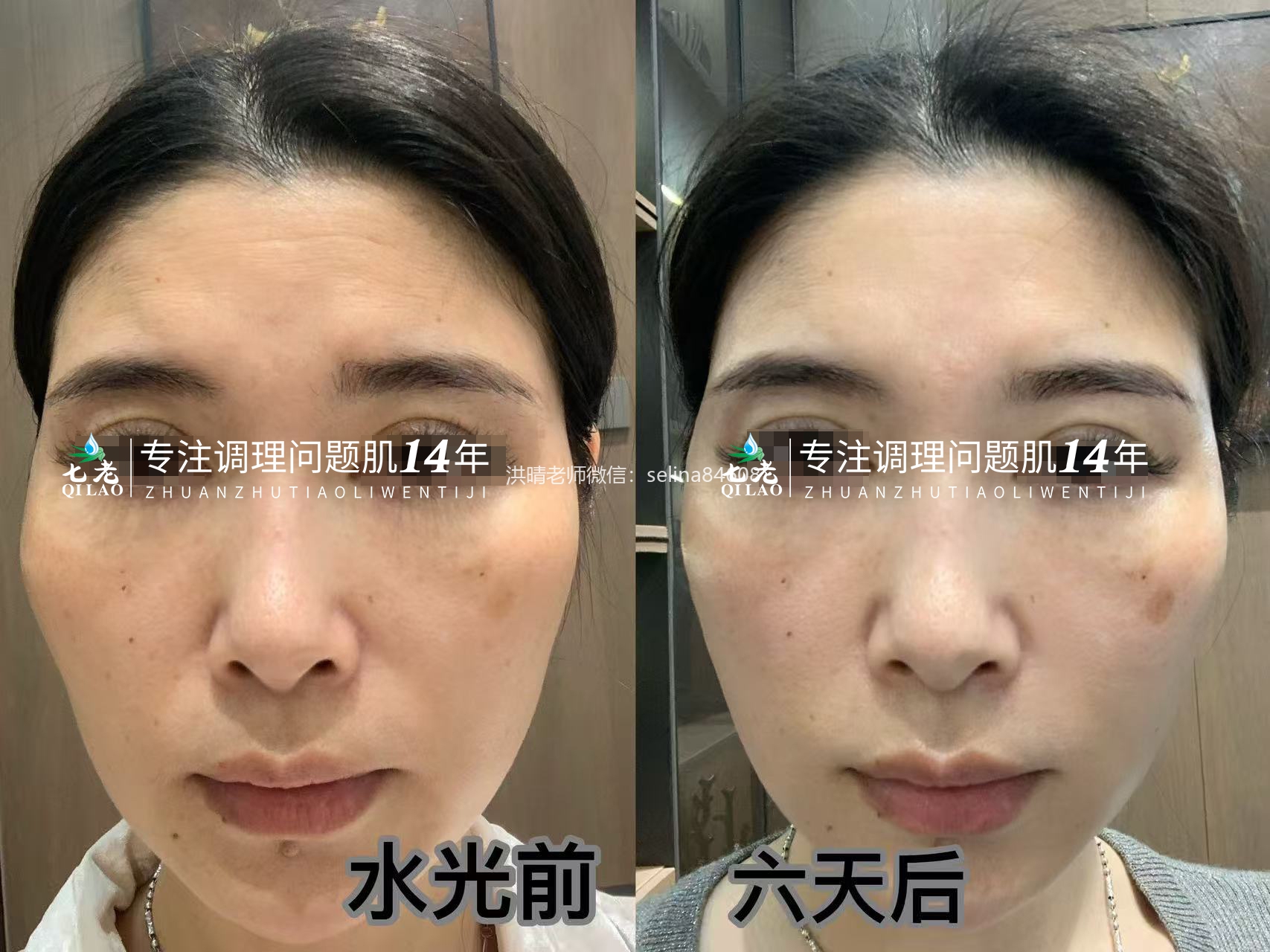 七老新品胶原水光→肌底修护，紧致抗衰于一体，让你皮肤胶原蛋白满满紧致白亮有光泽