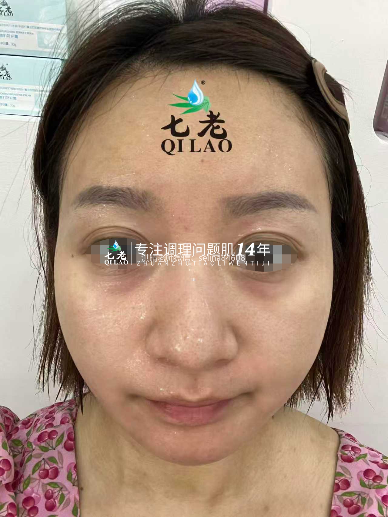 七老皮肤反复过敏红肿痒疹子修护案例