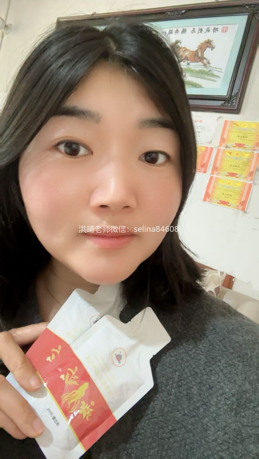 七老激素脸玫瑰痤疮修护案例