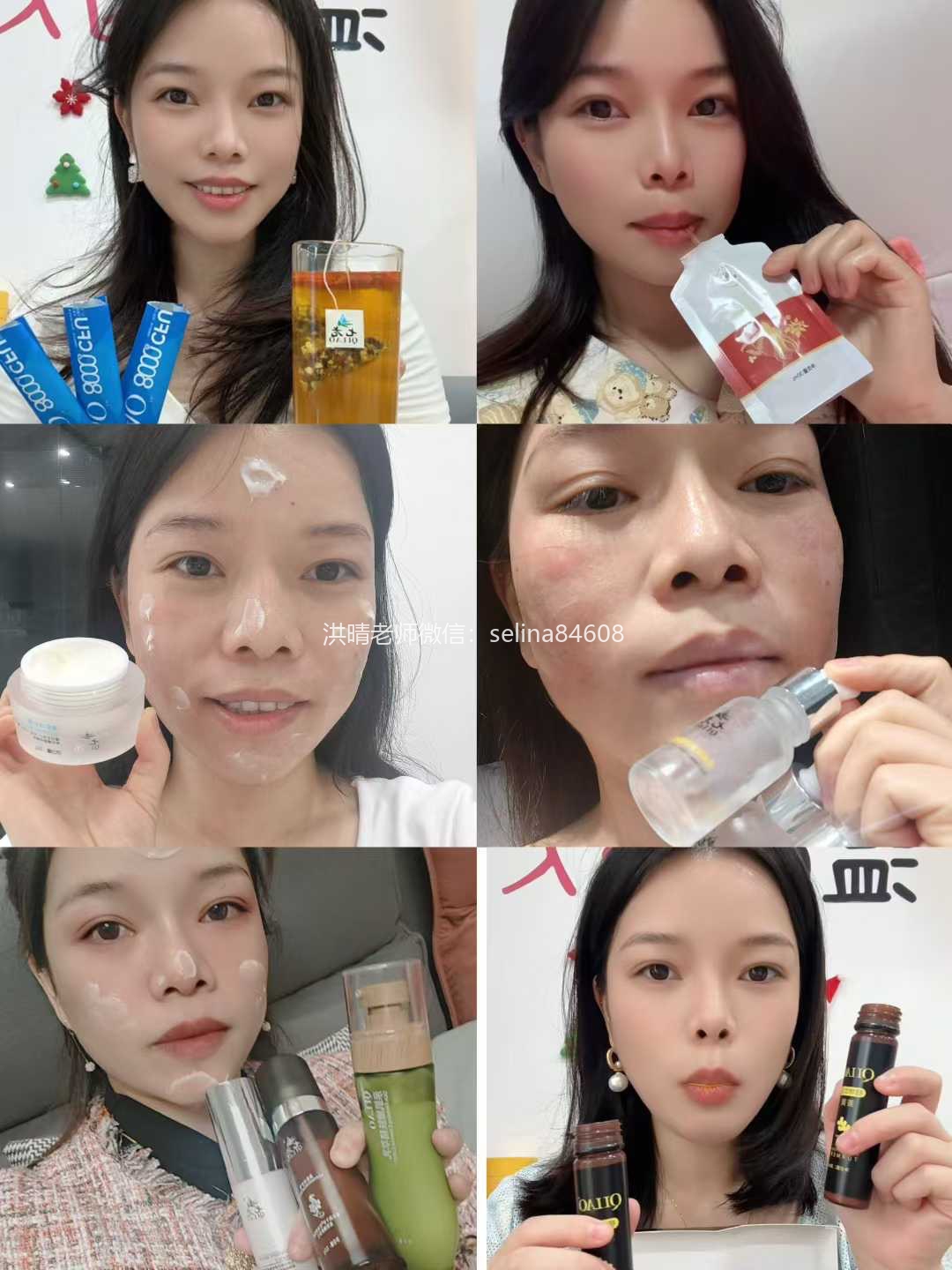 七老皮肤过敏反复红肿烫痒疹子修护案例