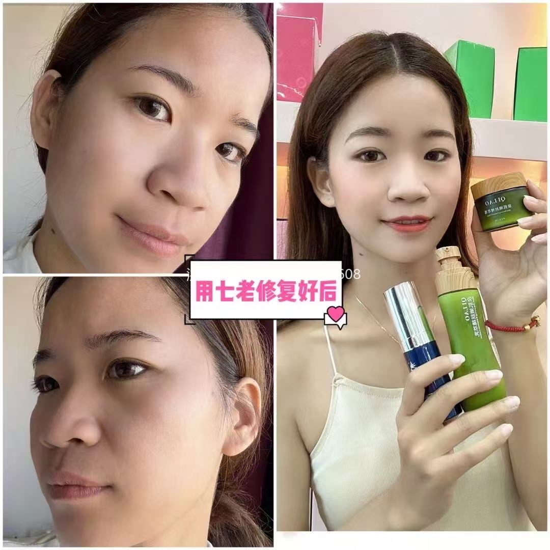 七老反复长痘敏感发红发烫修护案例