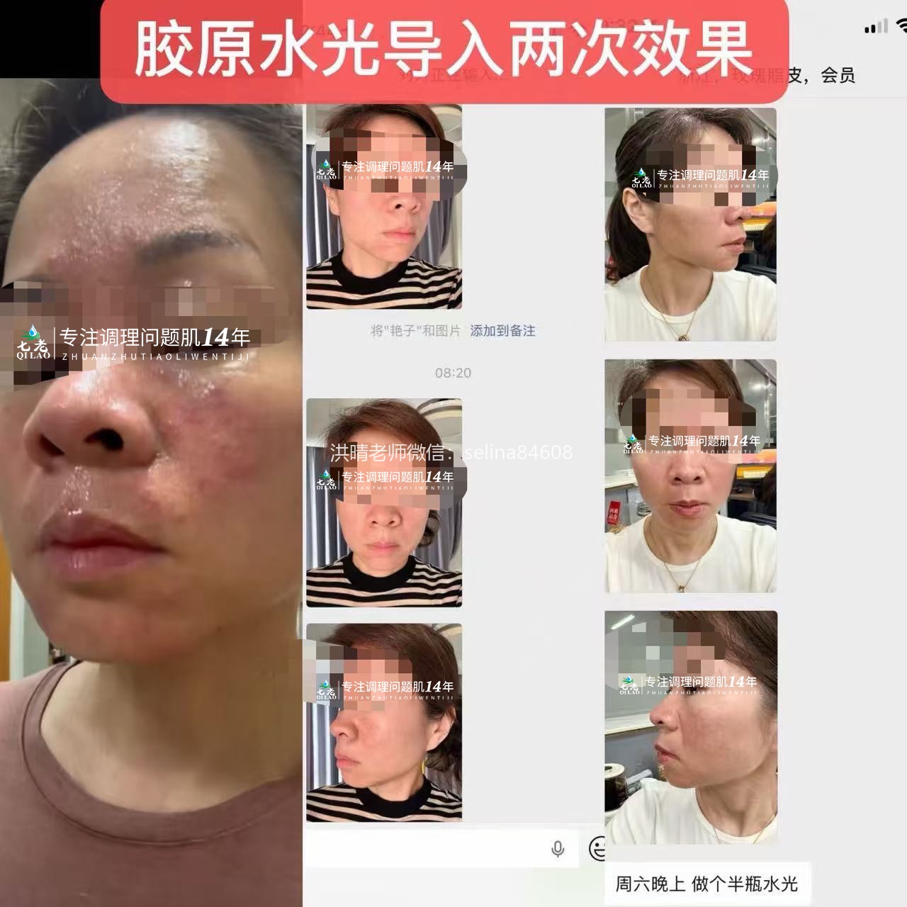 七老居家胶原水光，用了你就会爱上
