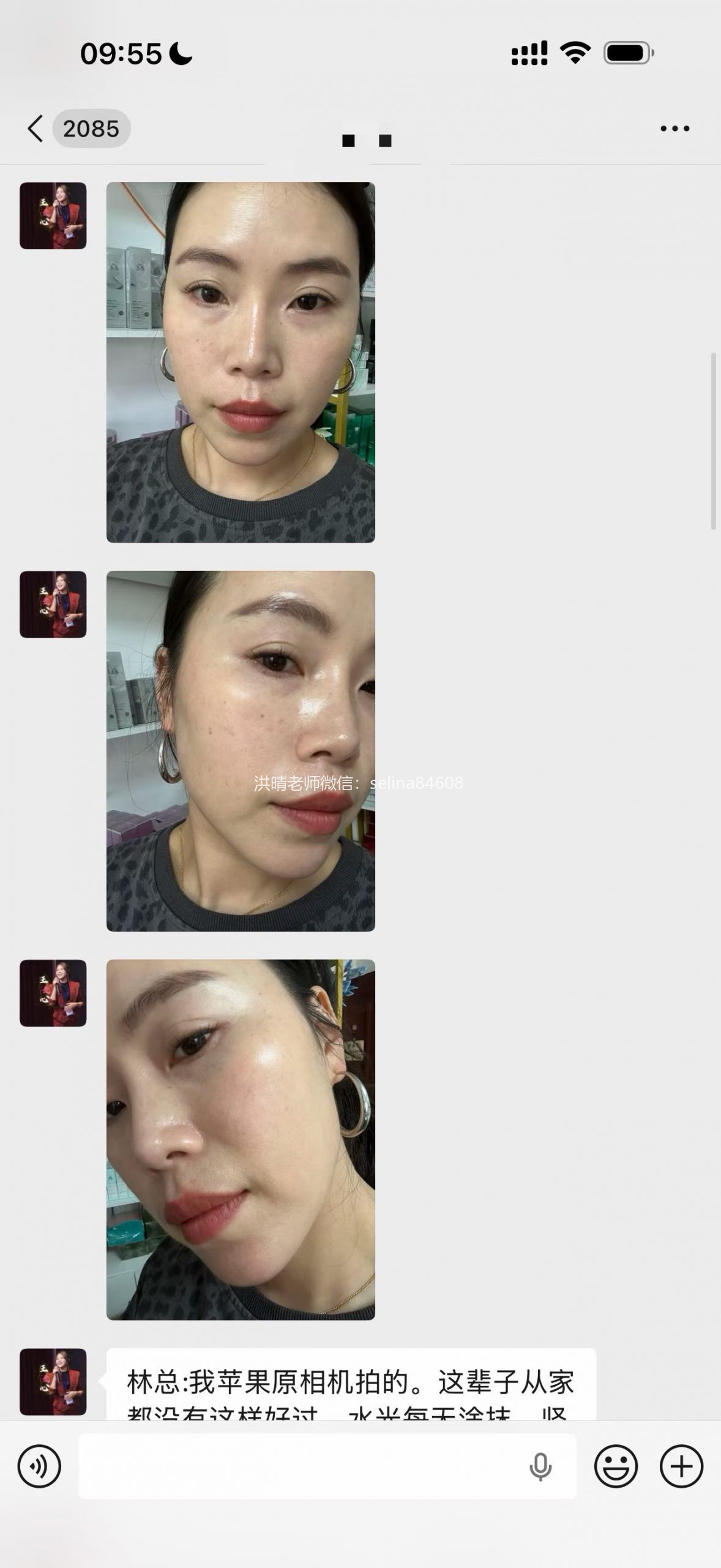 七老发红发烫红烫肌修护案例