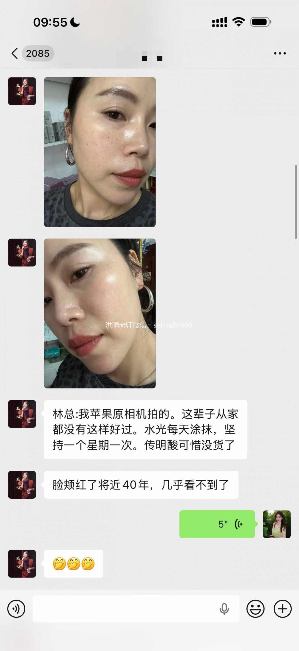七老发红发烫红烫肌修护案例