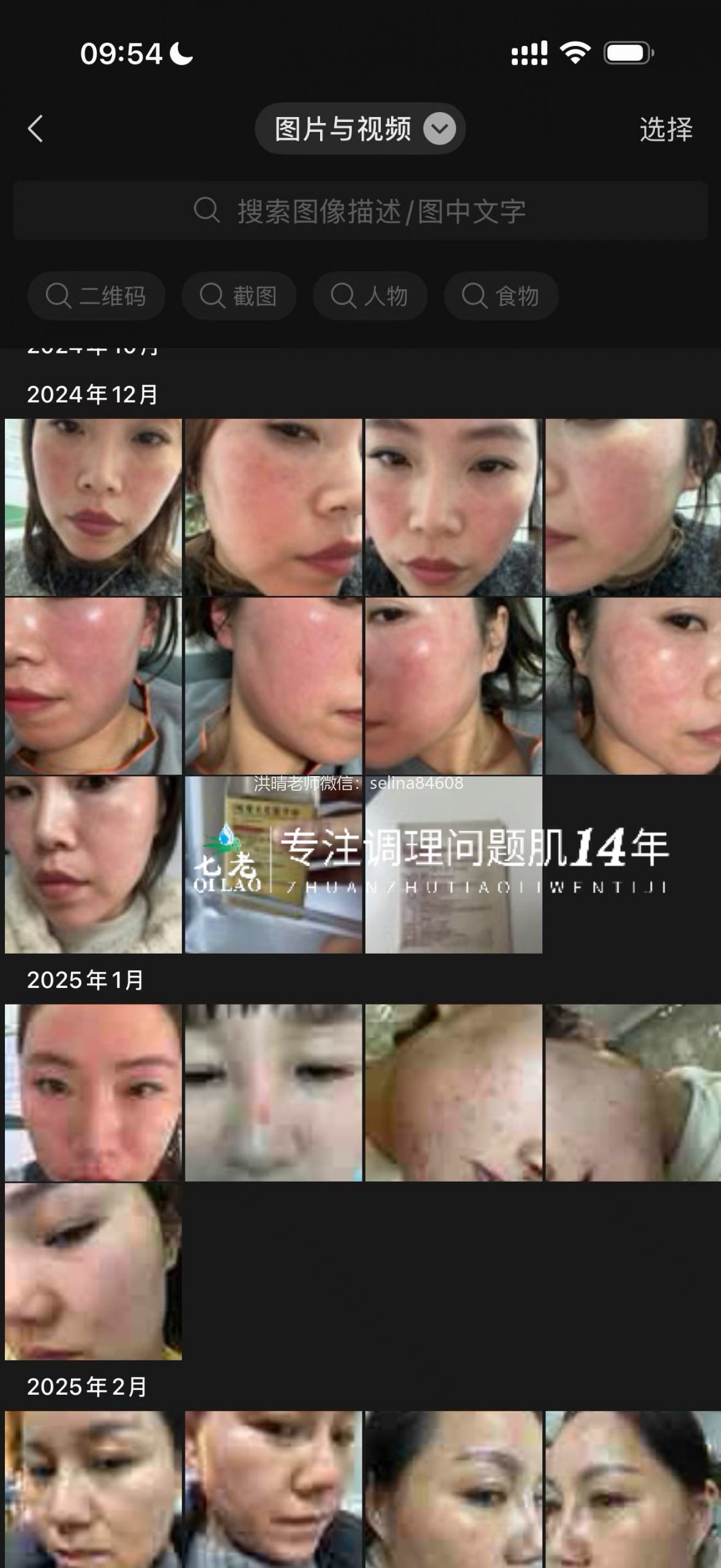 七老发红发烫红烫肌修护案例