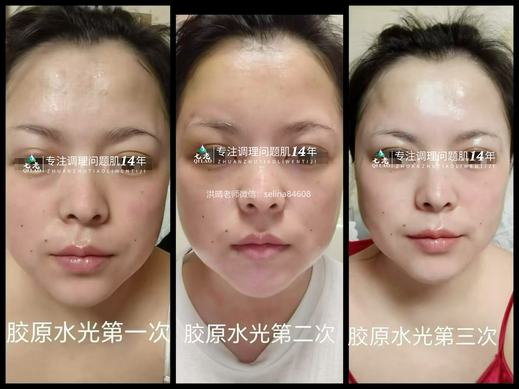 七老居家胶原水光，用了你就会爱上