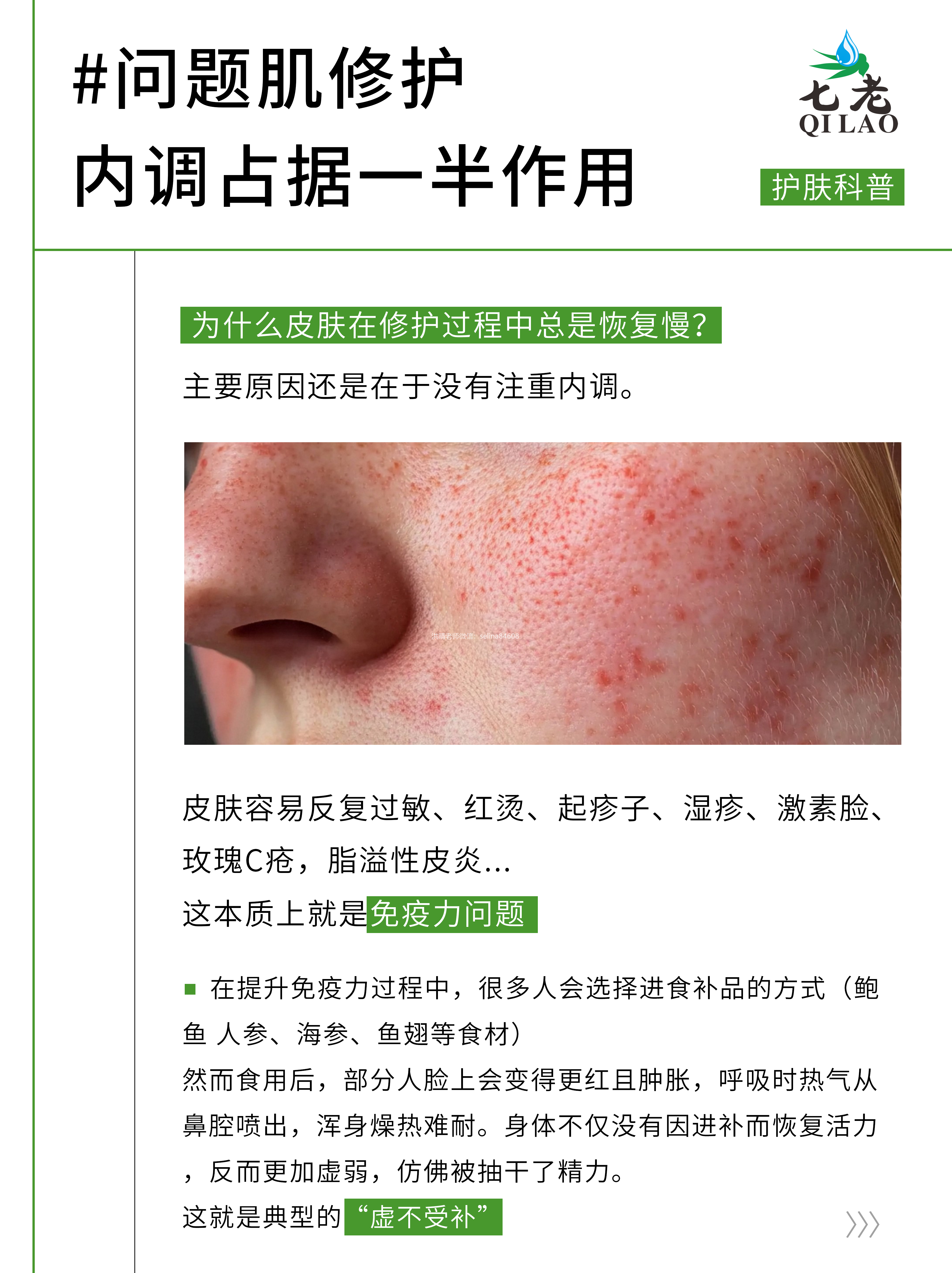 七老告诉你为什么你的皮肤总是反复恢复的慢？内调是关键