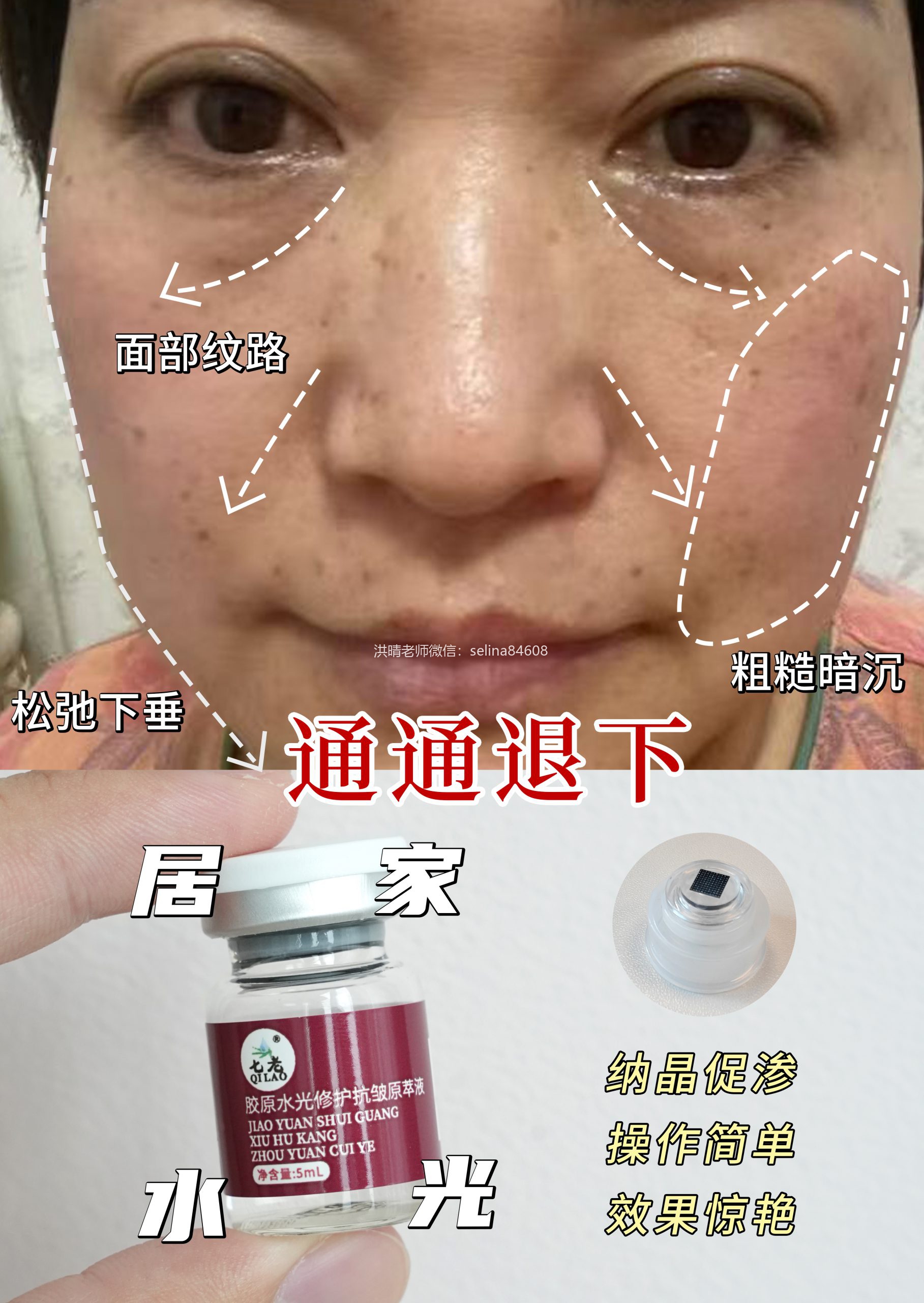 七老胶原水光，家居水光，补充胶原，修护紧致抗衰
