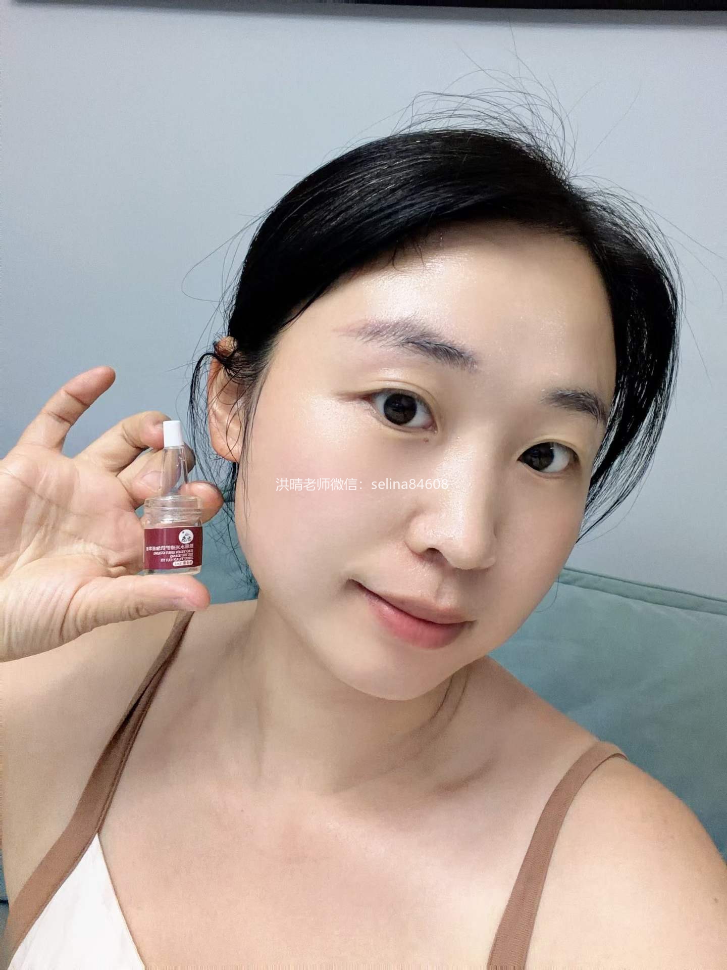七老干红烫肿痒疹子疙瘩修护案例