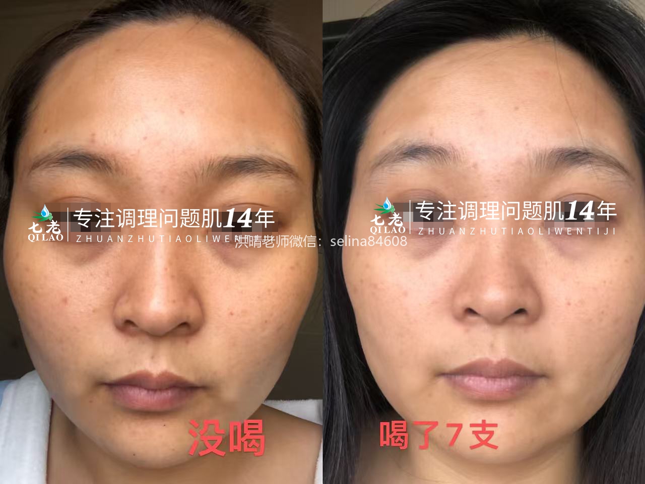 七老四重肽胶原蛋白→敏感肌内调抗衰的天花板