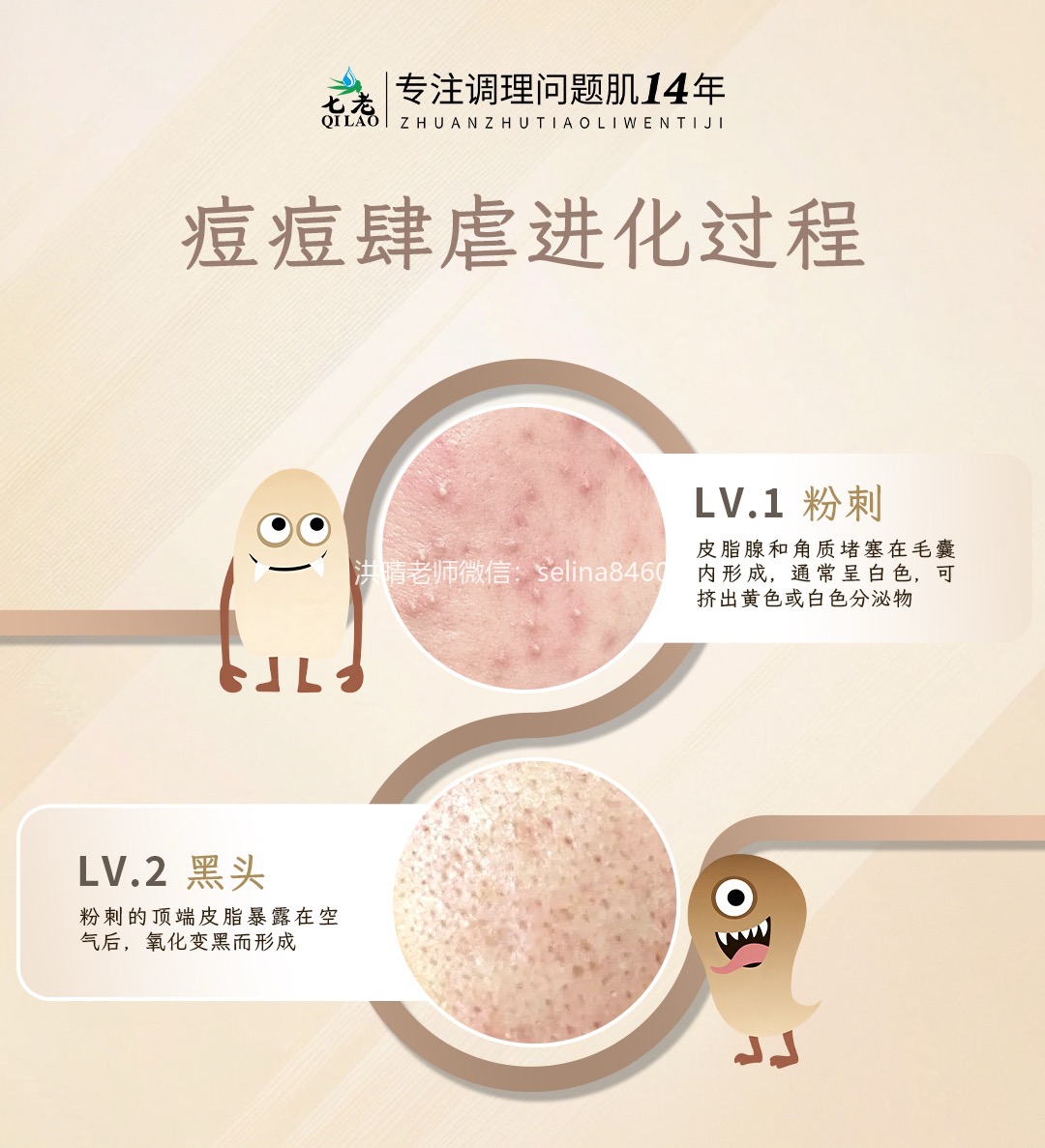 七老洪晴专业知识科普→痘痘痤疮严重程度怎么区分？