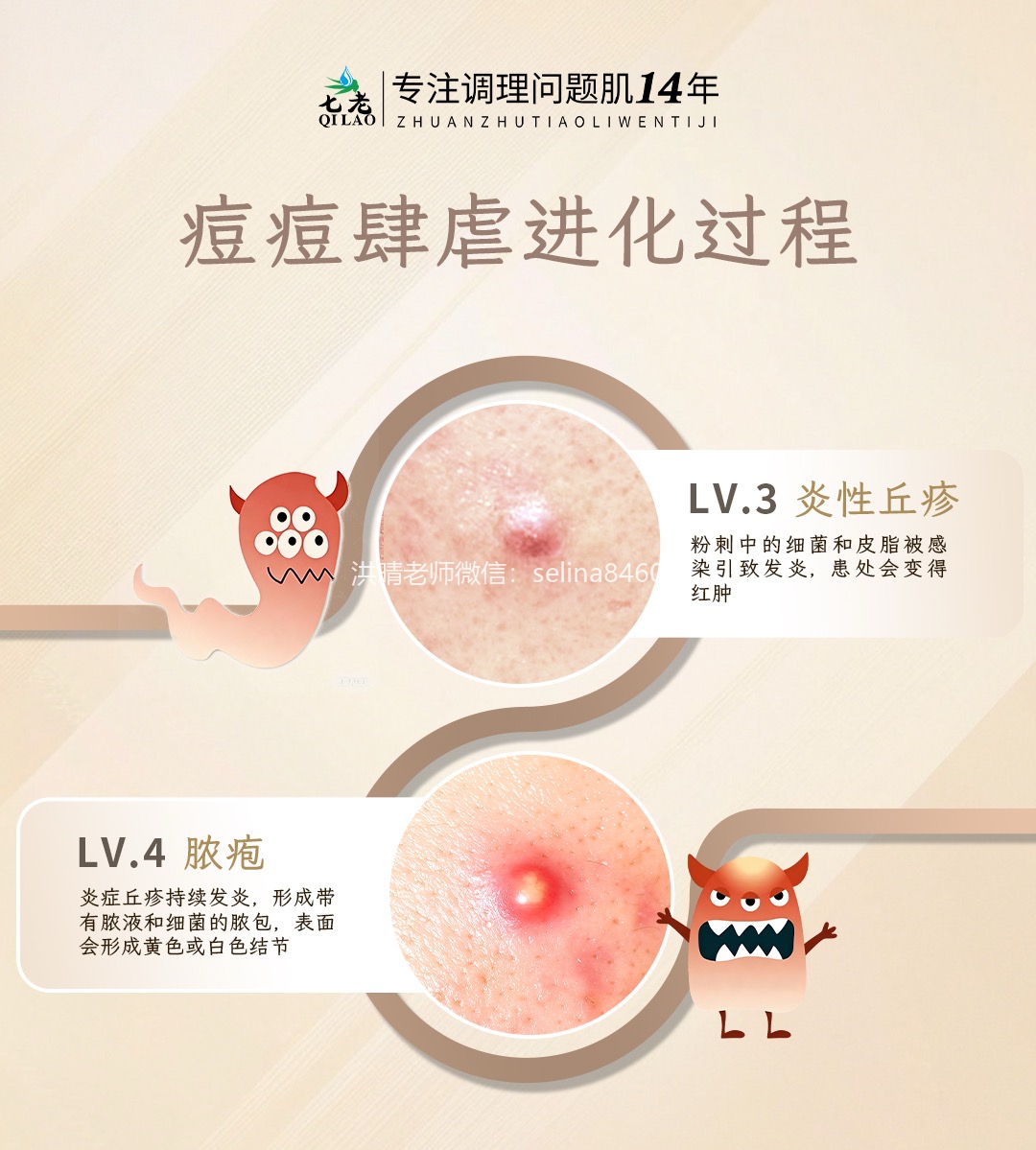 七老洪晴专业知识科普→痘痘痤疮严重程度怎么区分？