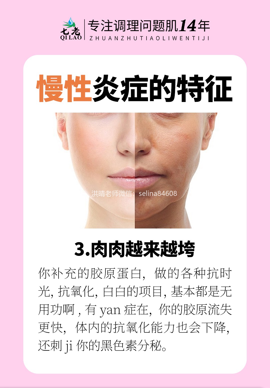 七老洪晴专业知识科普→看看你是不是慢性炎症体质