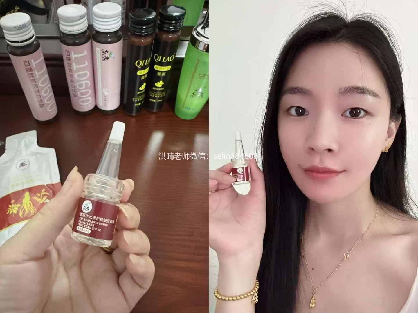 七老胶原水光抬头纹对比效果，激素脸激素痘修护过来的，谁能看出她曾经那么严重的痘肌烂脸