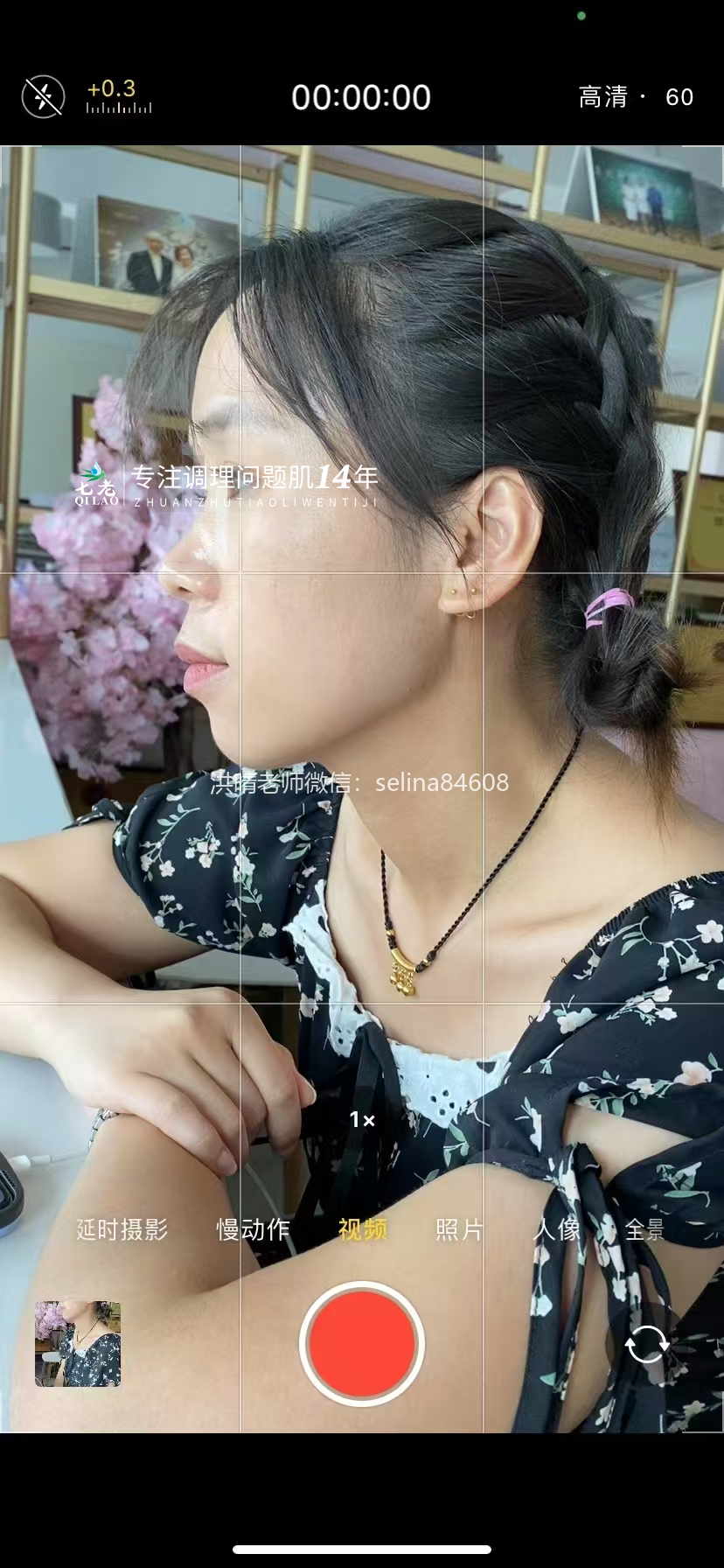 七老顽固粉刺痘痘修护案例