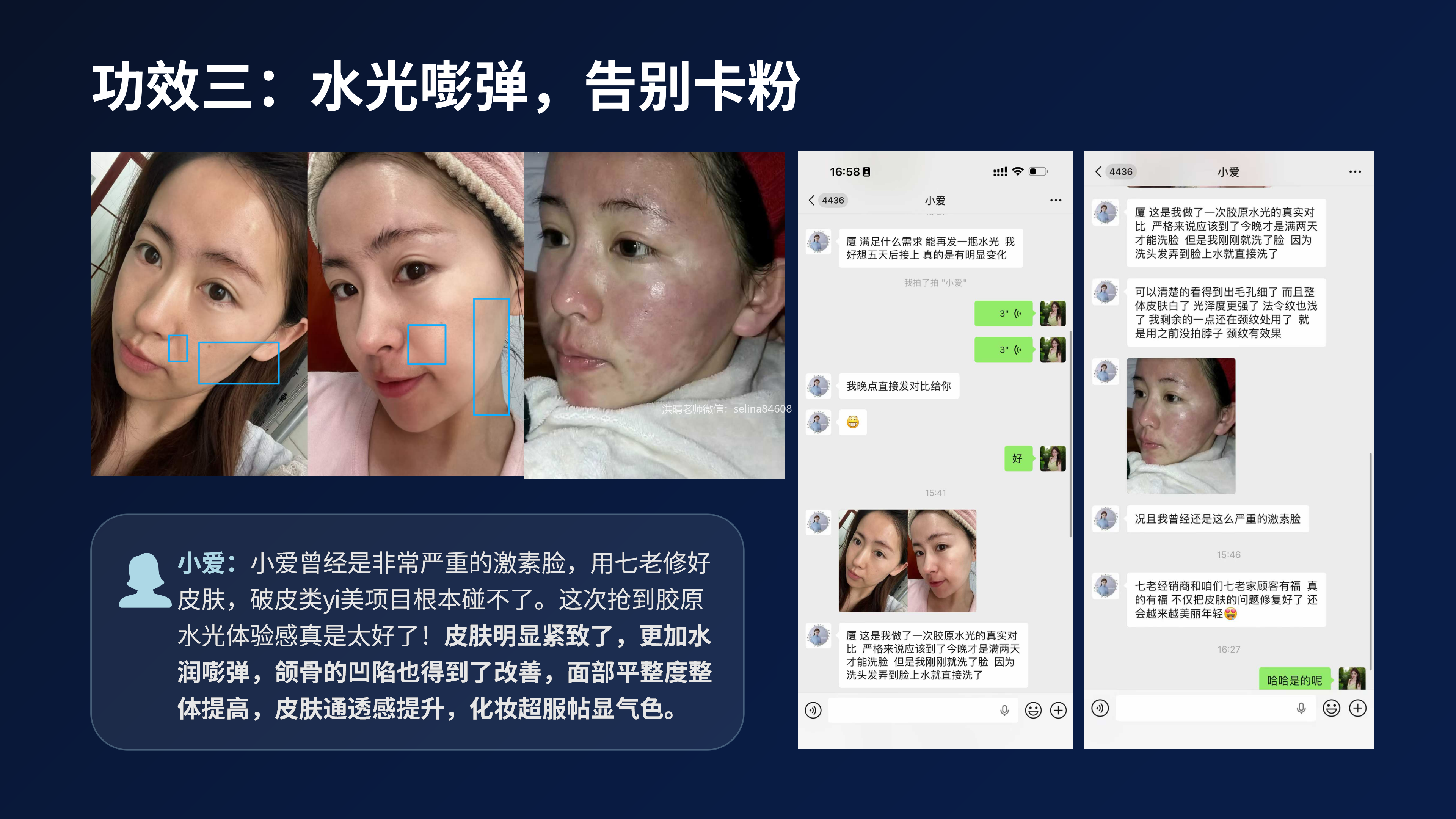 七老胶原水光修护案例，敏肌抗衰天花板