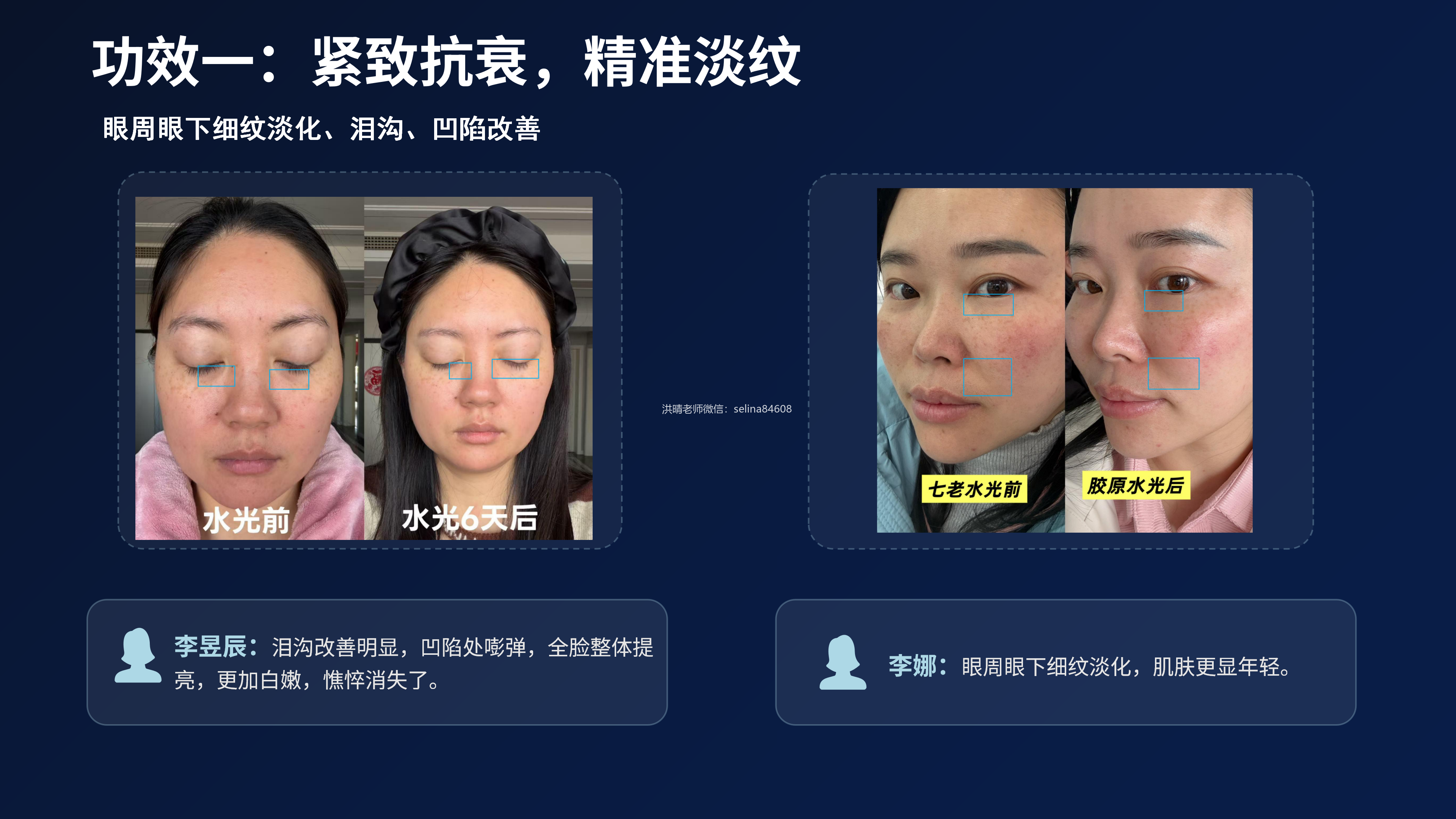 七老胶原水光修护案例，敏肌抗衰天花板