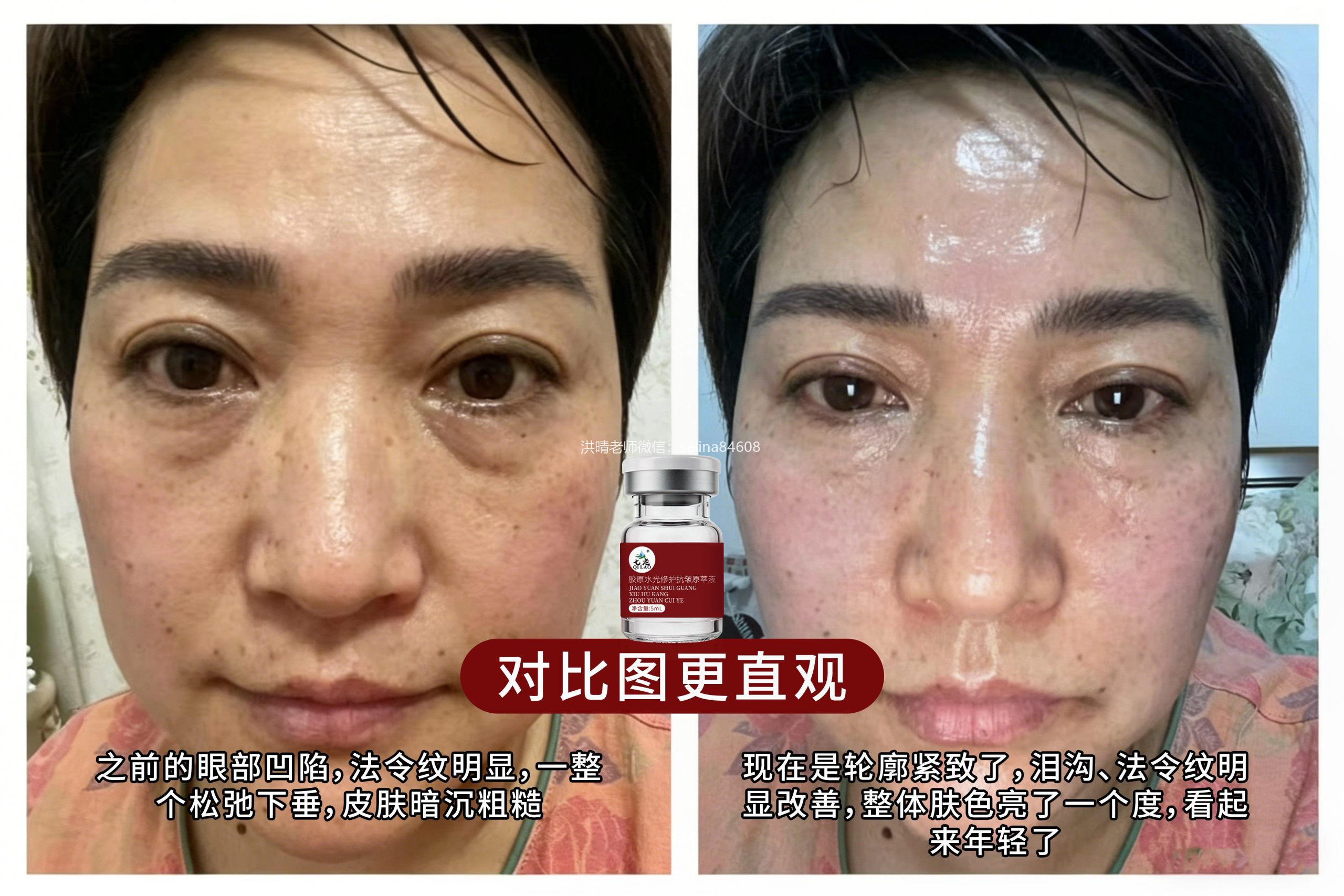 七老胶原水光
