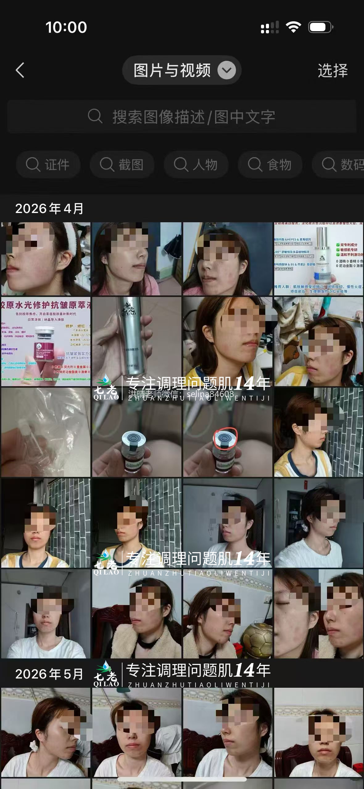 七老敏感肌泛红刺痛用胶原水光三个月对比