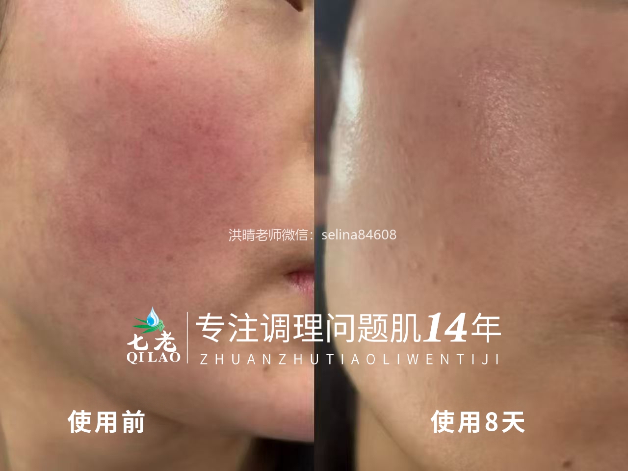 七老传明酸精华