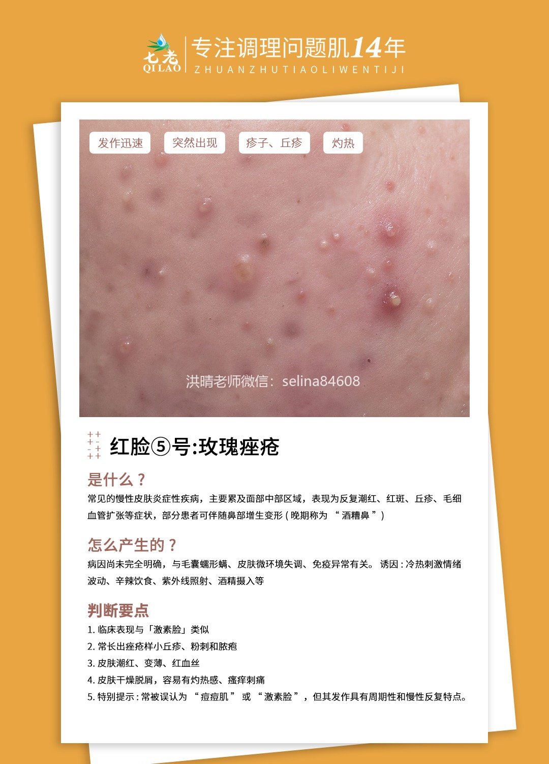 七老洪晴专业知识科普→一分钟教你辨别大红脸的类型