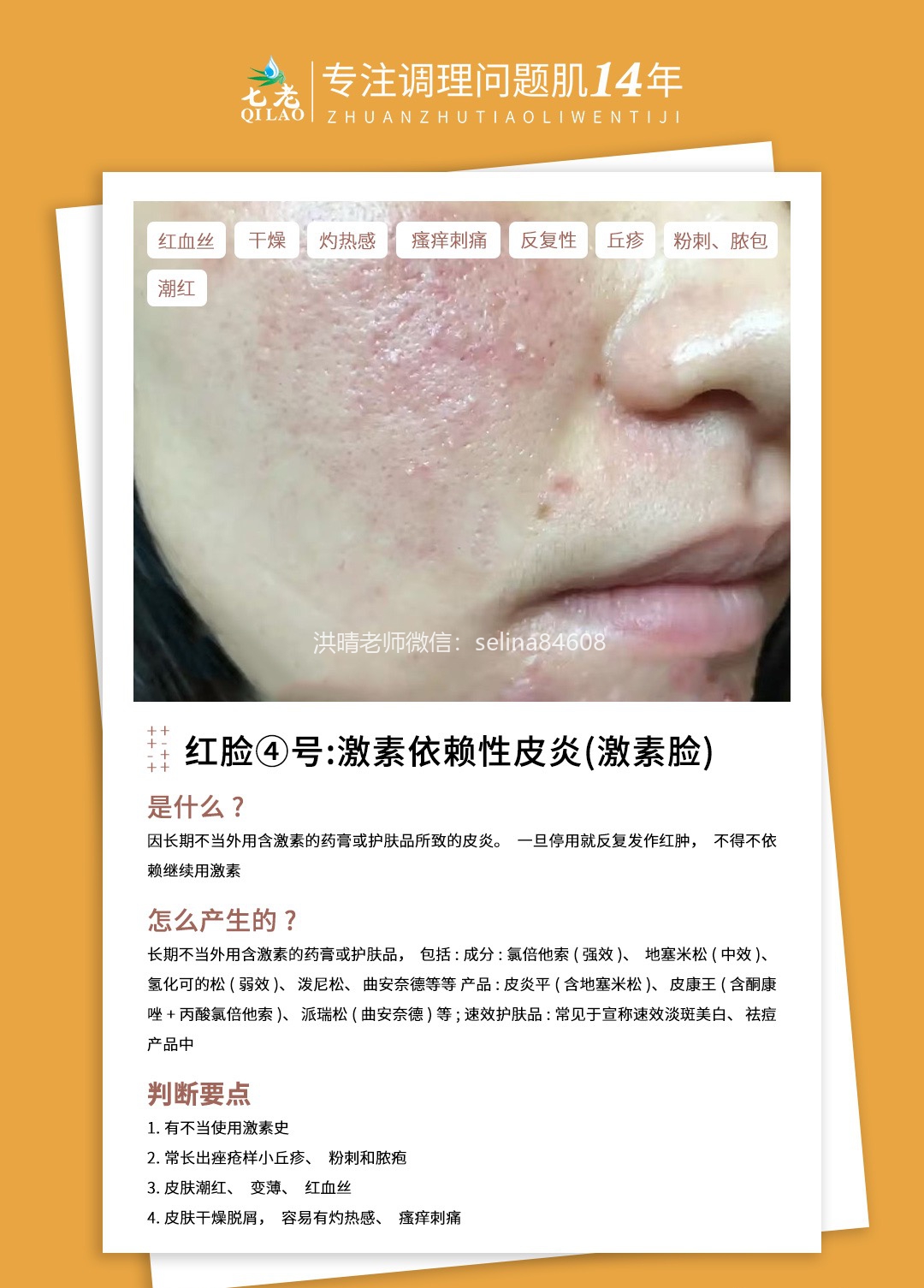 七老洪晴专业知识科普→一分钟教你辨别大红脸的类型