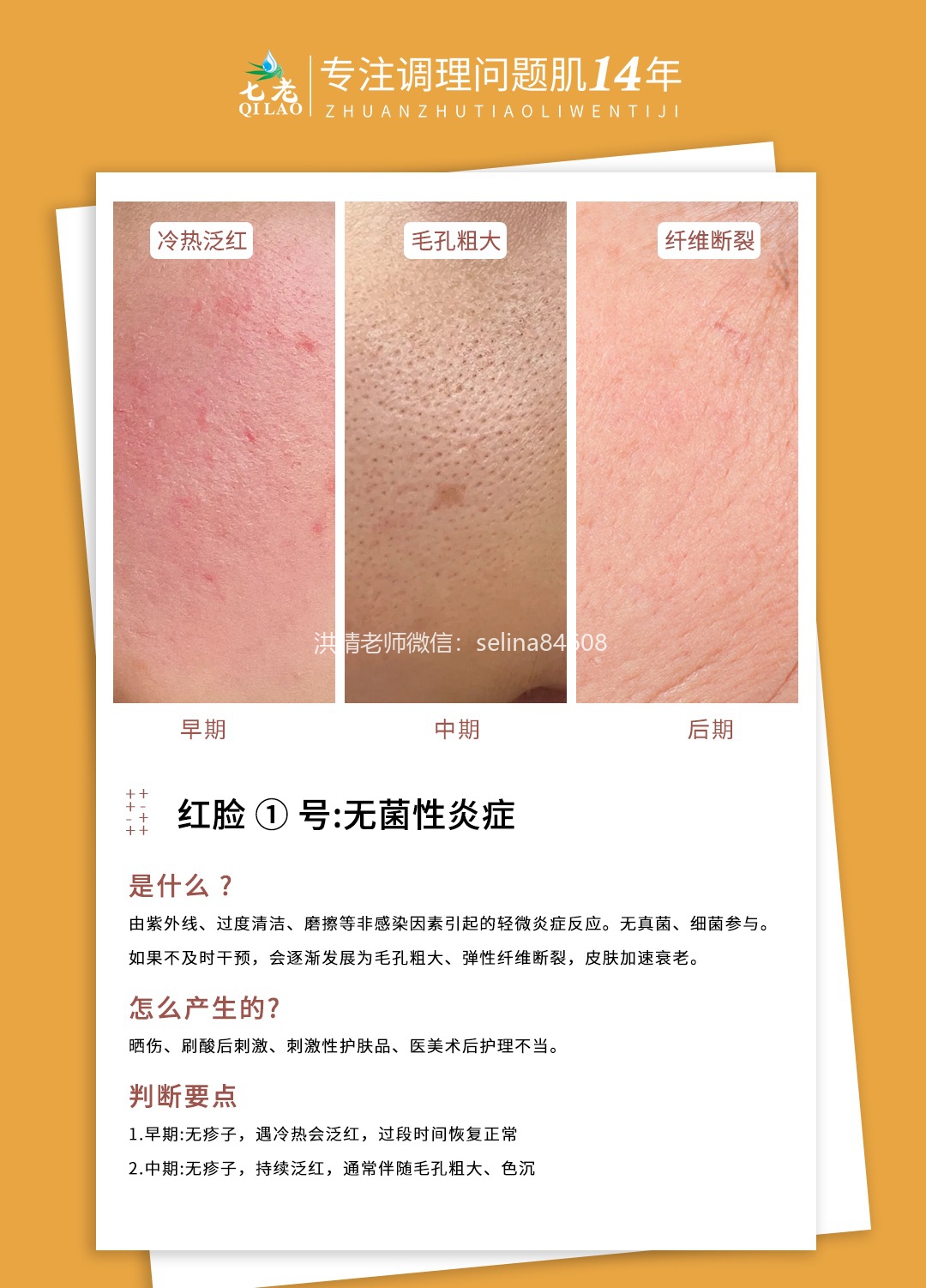 七老洪晴专业知识科普→一分钟教你辨别大红脸的类型