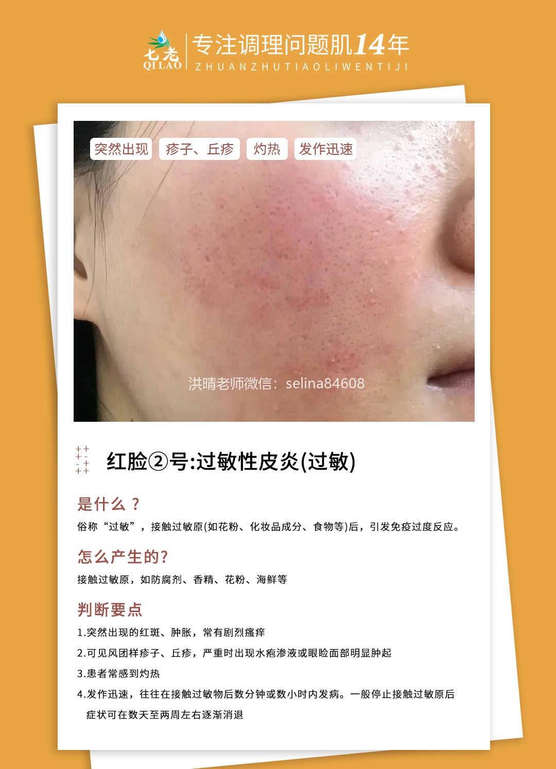 七老洪晴专业知识科普→一分钟教你辨别大红脸的类型