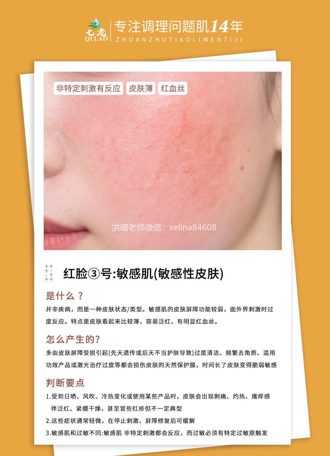 七老洪晴专业知识科普→一分钟教你辨别大红脸的类型