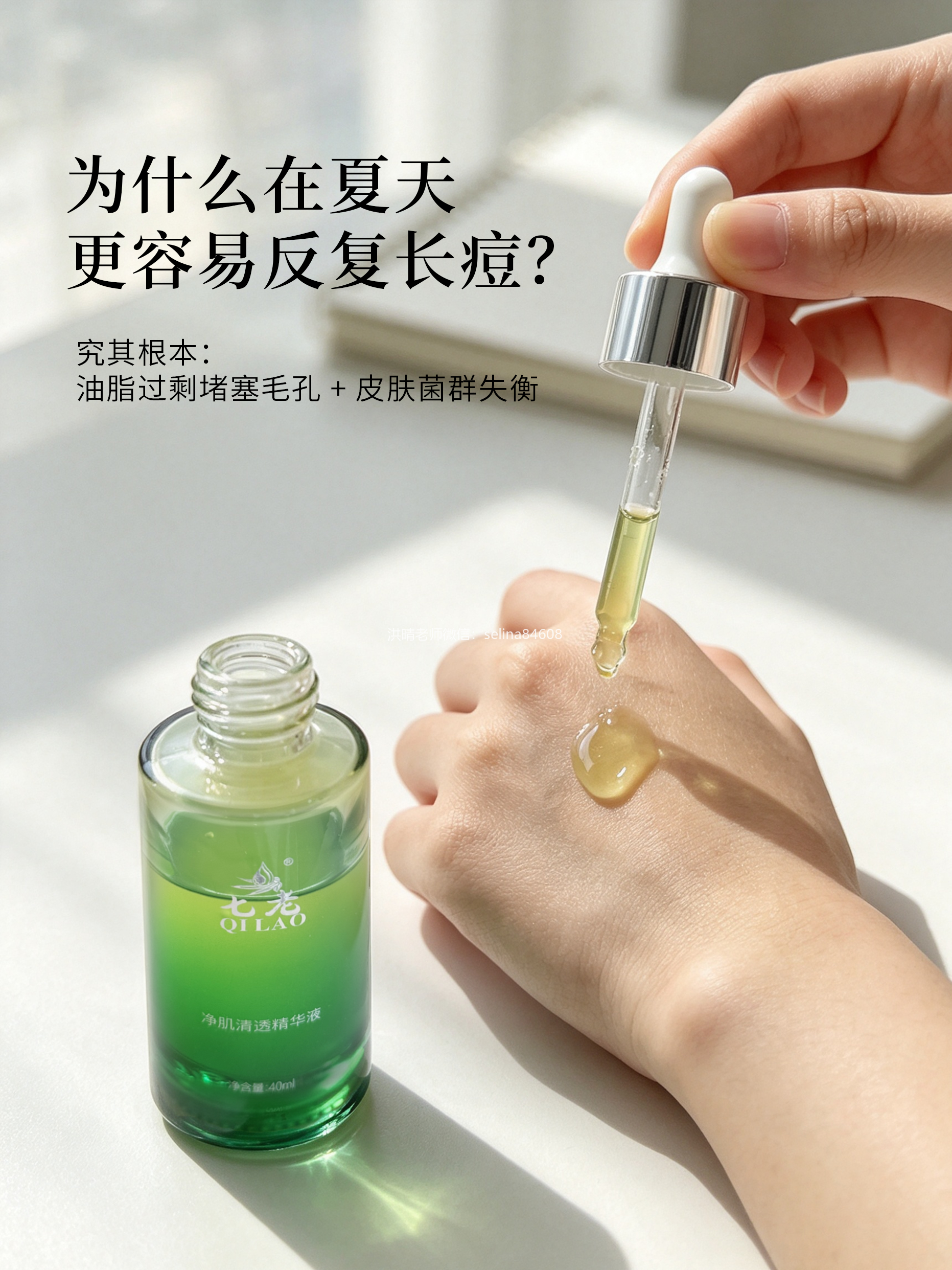 一到夏天就长疹子长疙瘩闭口粉刺痘痘的姐妹一定要看