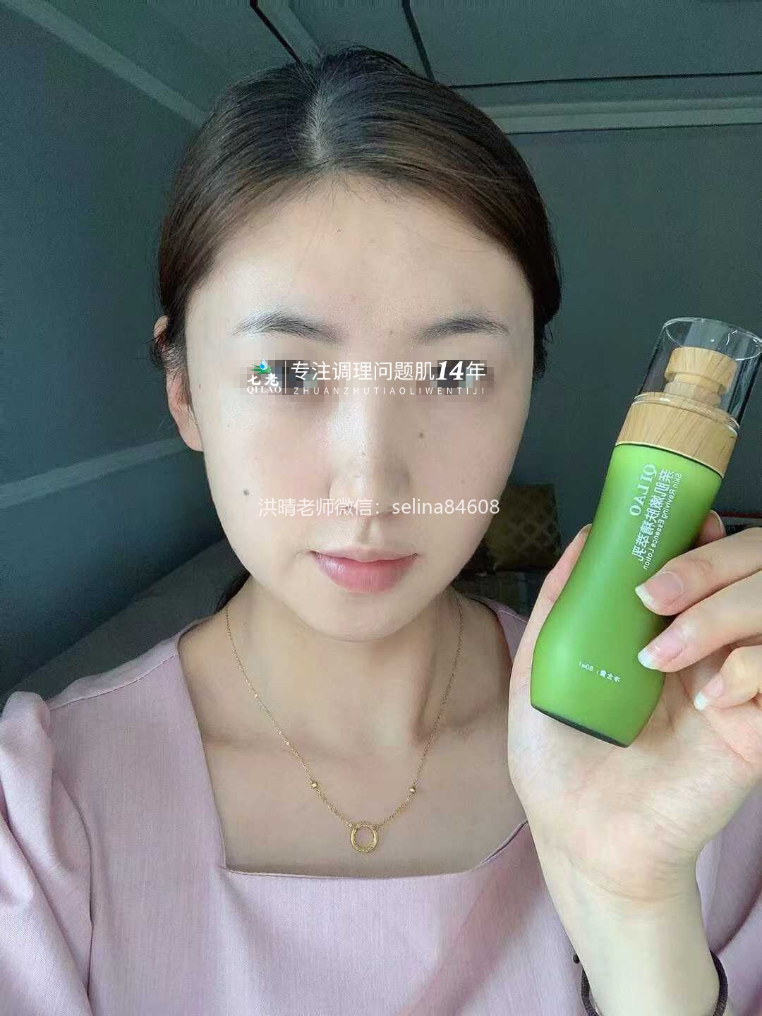 七老红烫肌修护案例