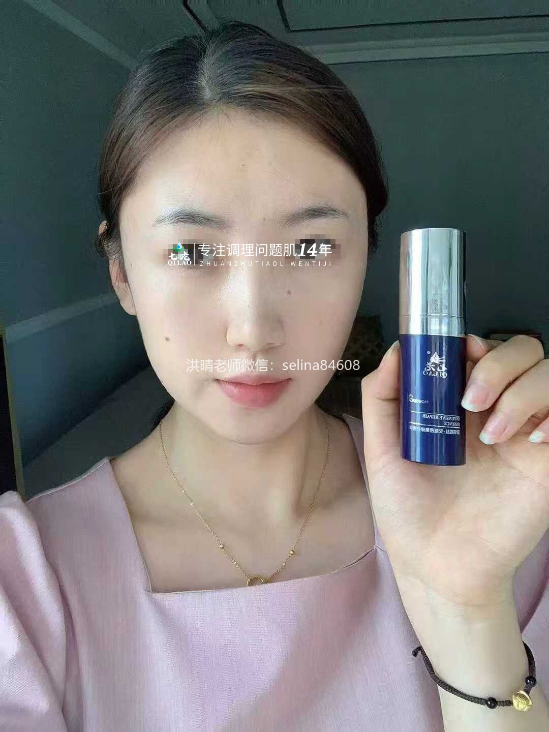 七老红烫肌修护案例