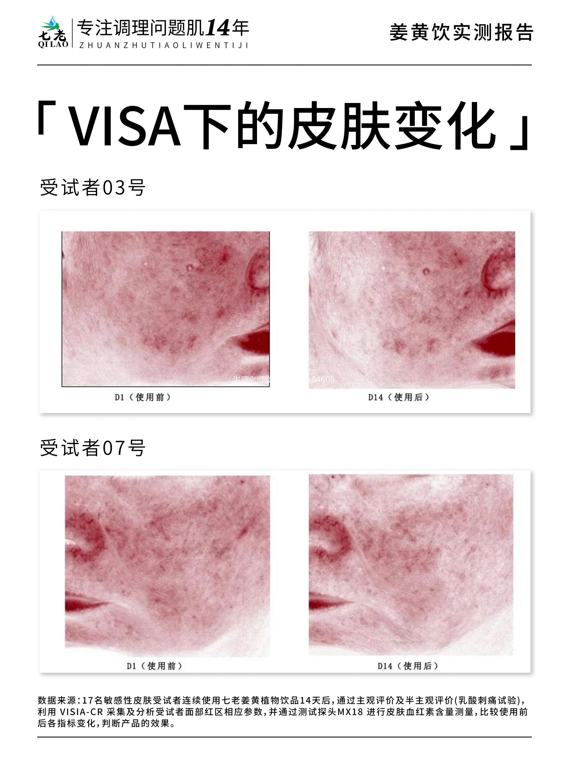 七老姜黄抗炎饮→内调抗炎，调理慢性炎症
